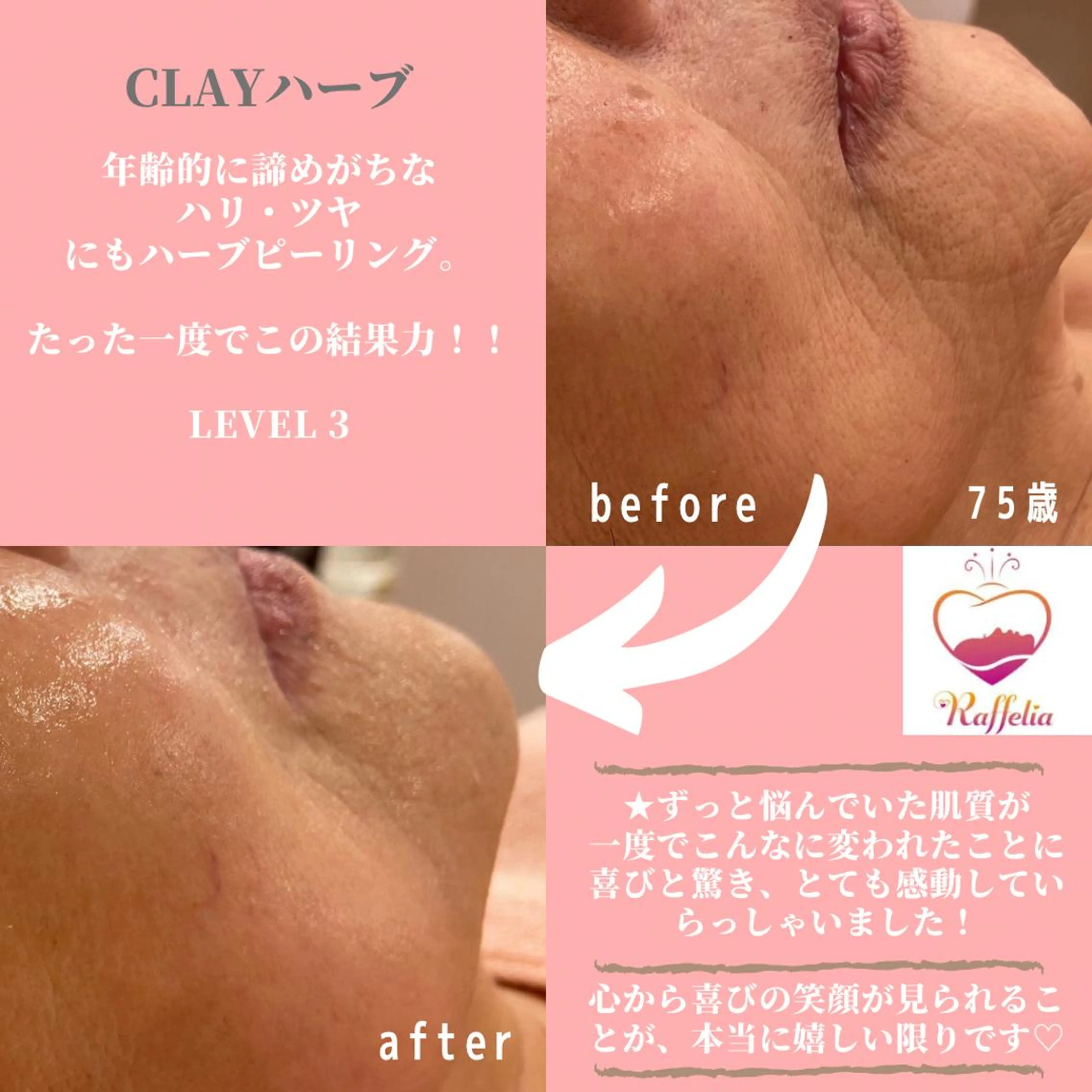 🌈Raffelia ラフェリア✨のエステ・リラクイメージ