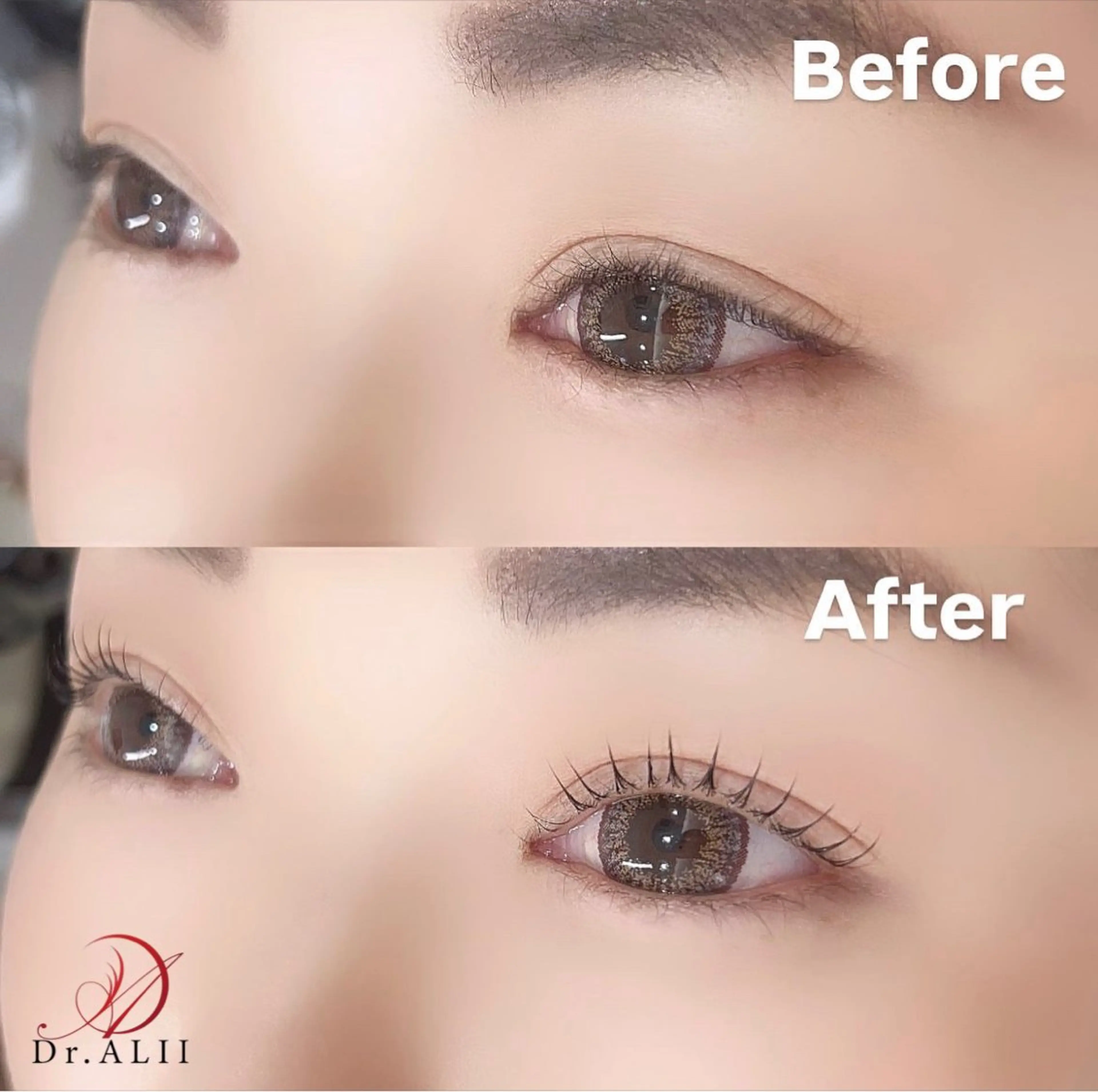 マツエク・マツパ 一重×まつ毛パーマ Dr.ALII岐南店所属・Dr.ALII 岐南店 鈴村のエステ・リラクイメージ