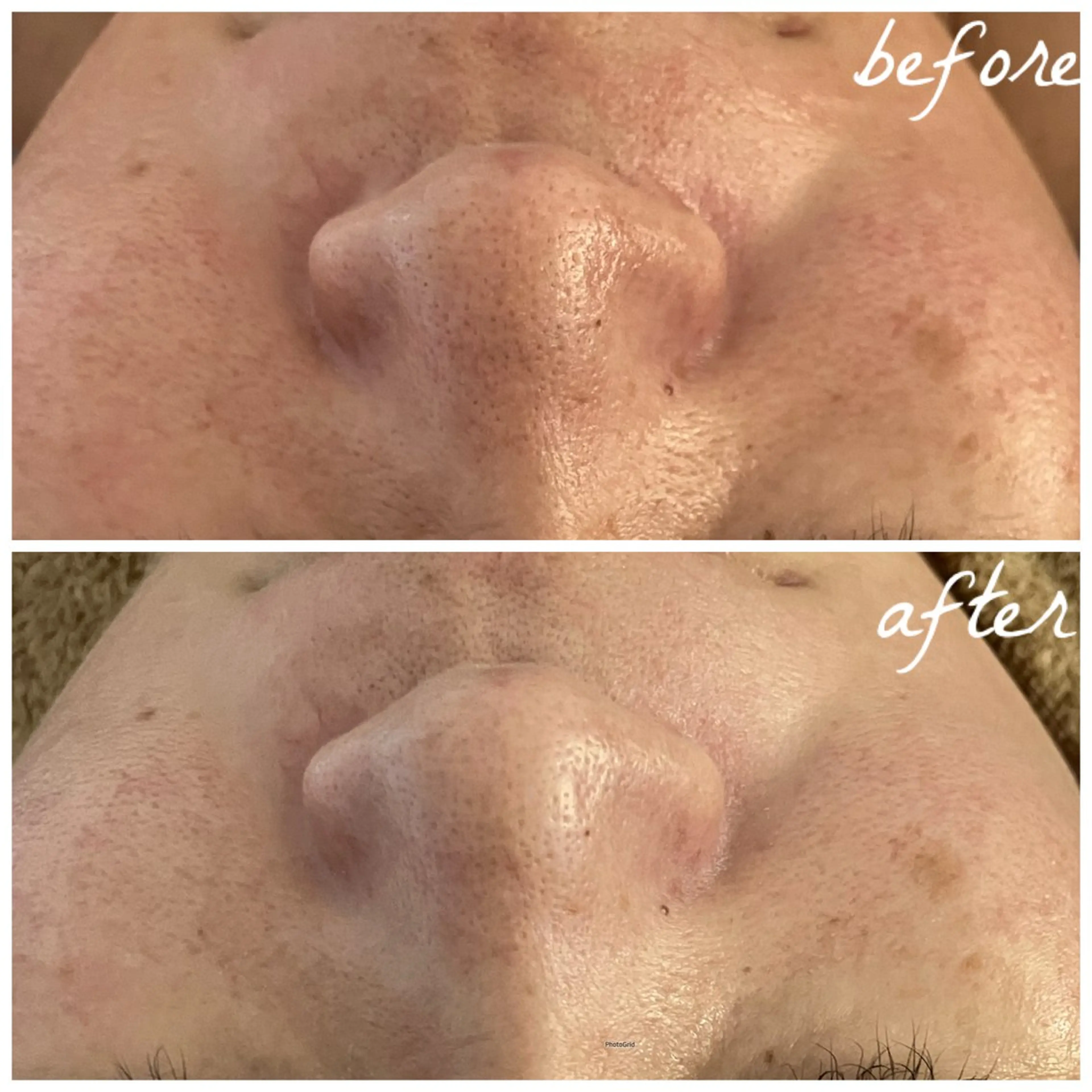 メンズ エステ メナード岐阜茜部 杉浦のエステ・リラクイメージ