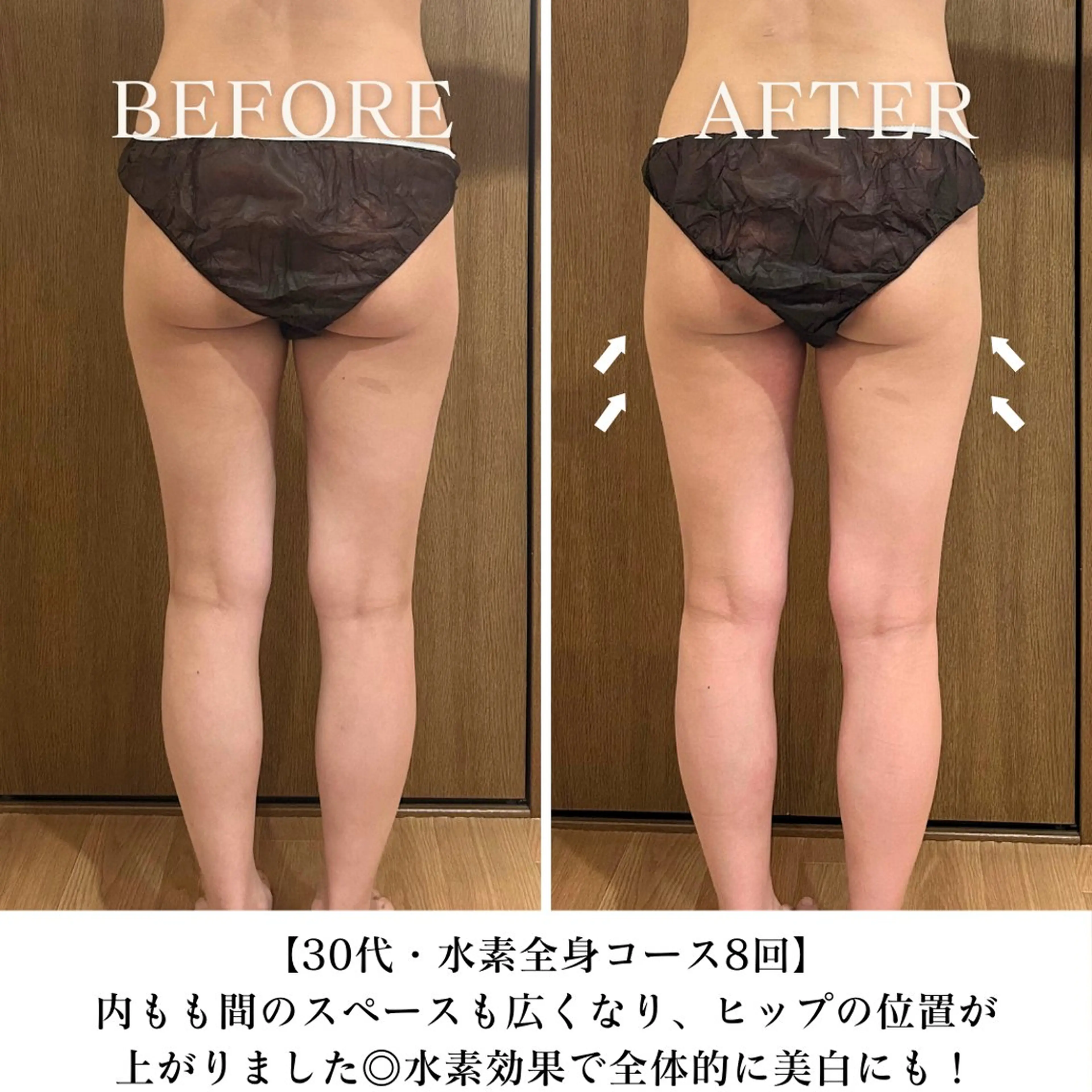 【目黒】本格痩身✴︎ 最新型よもぎ蒸しのエステ・リラクイメージ