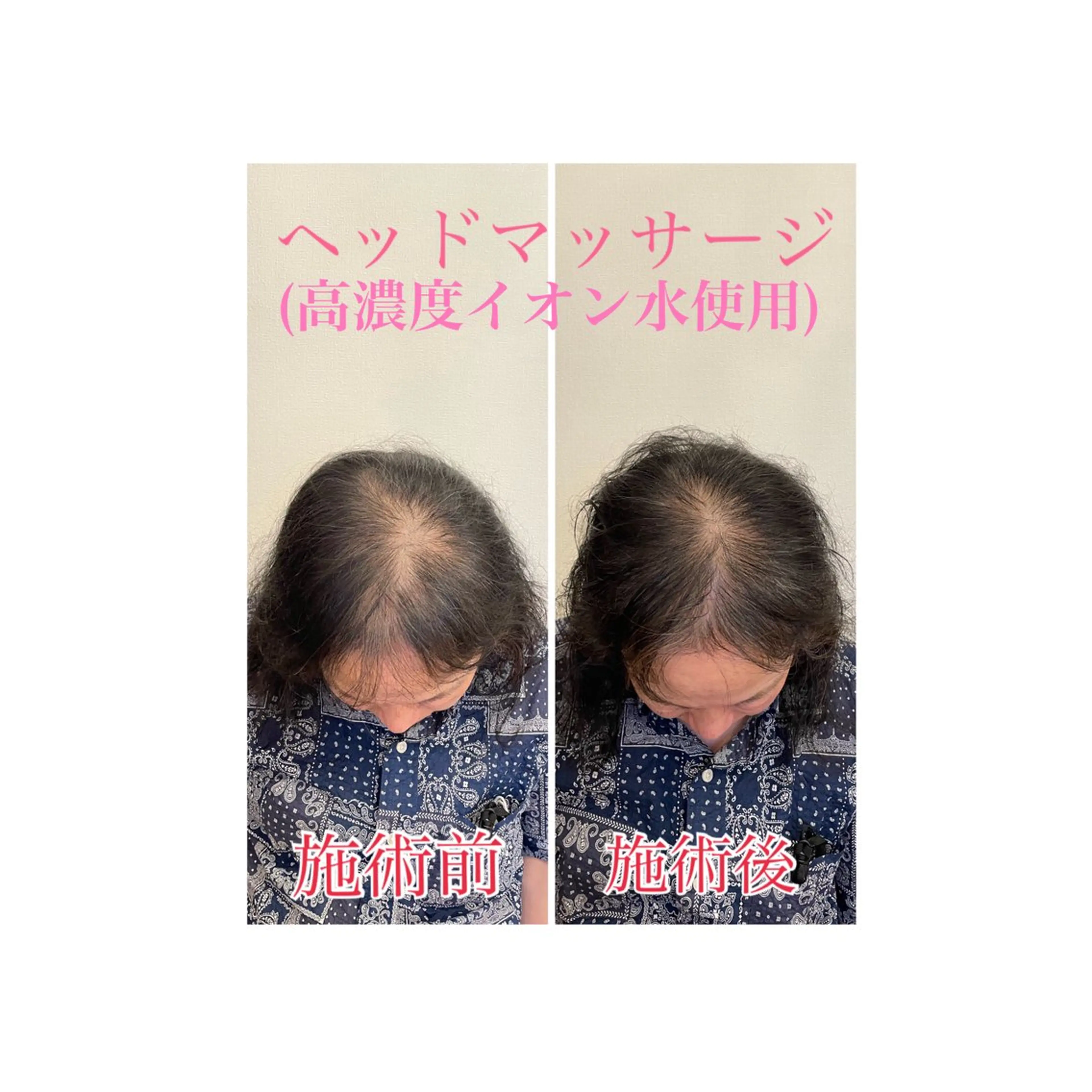 町田・鶴川 小顔矯正 /鈴木友実のエステ・リラクイメージ