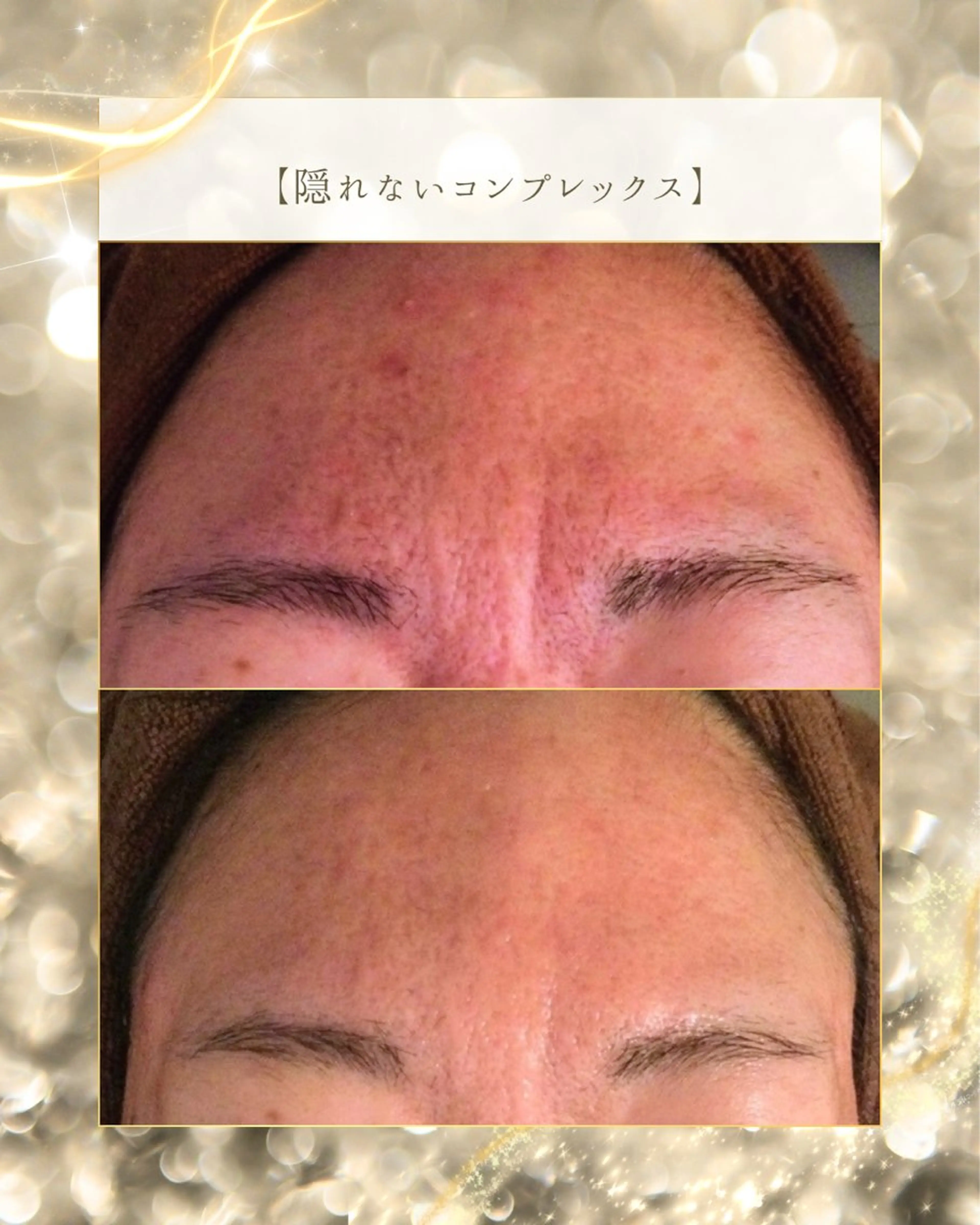 ニキビ/肌質改善専門 Snow skinのエステ・リラクイメージ