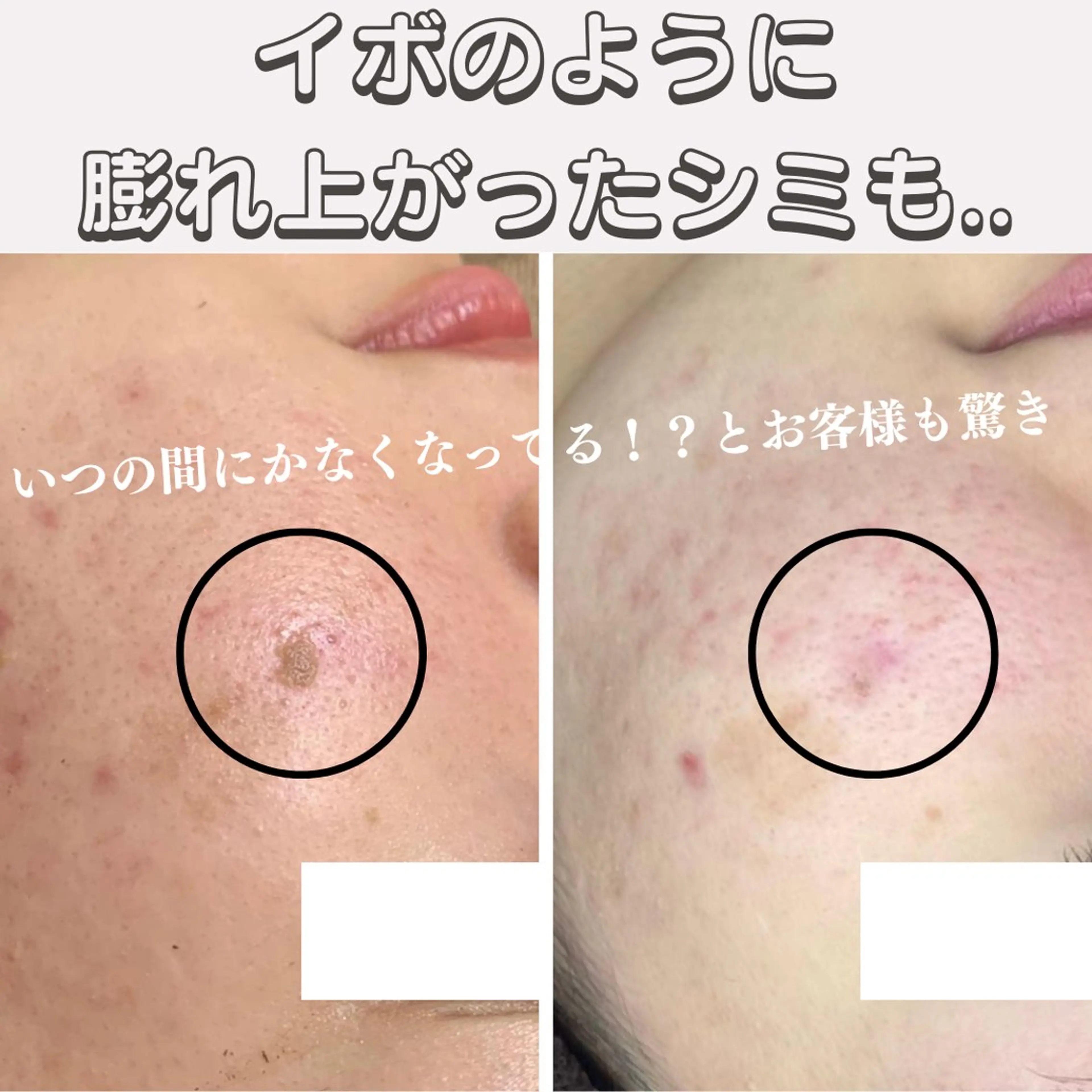 エステ 最新シミケアLily de pearlのエステ・リラクイメージ