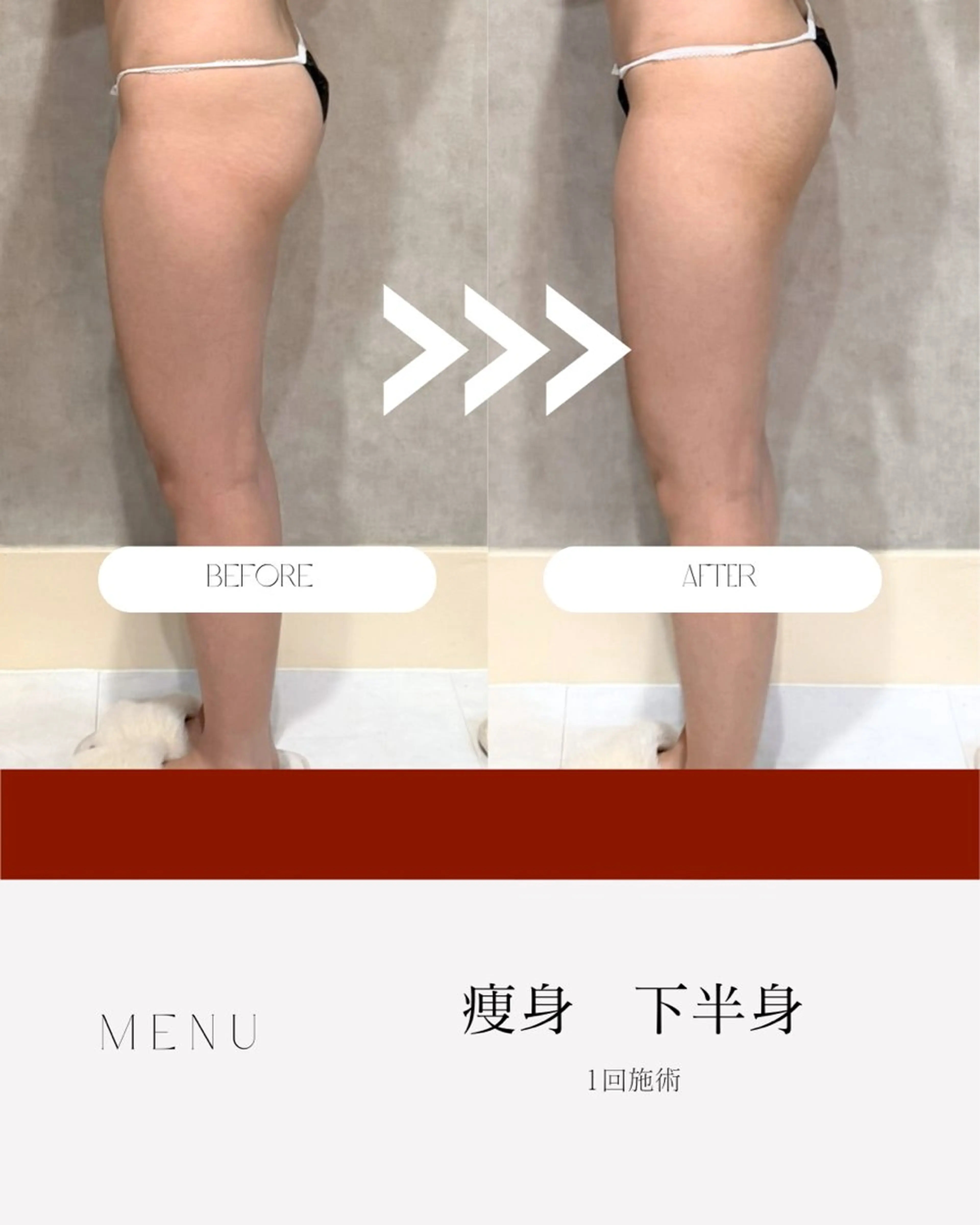 肌質改善✖️ 小顔｜Rikaのエステ・リラクイメージ