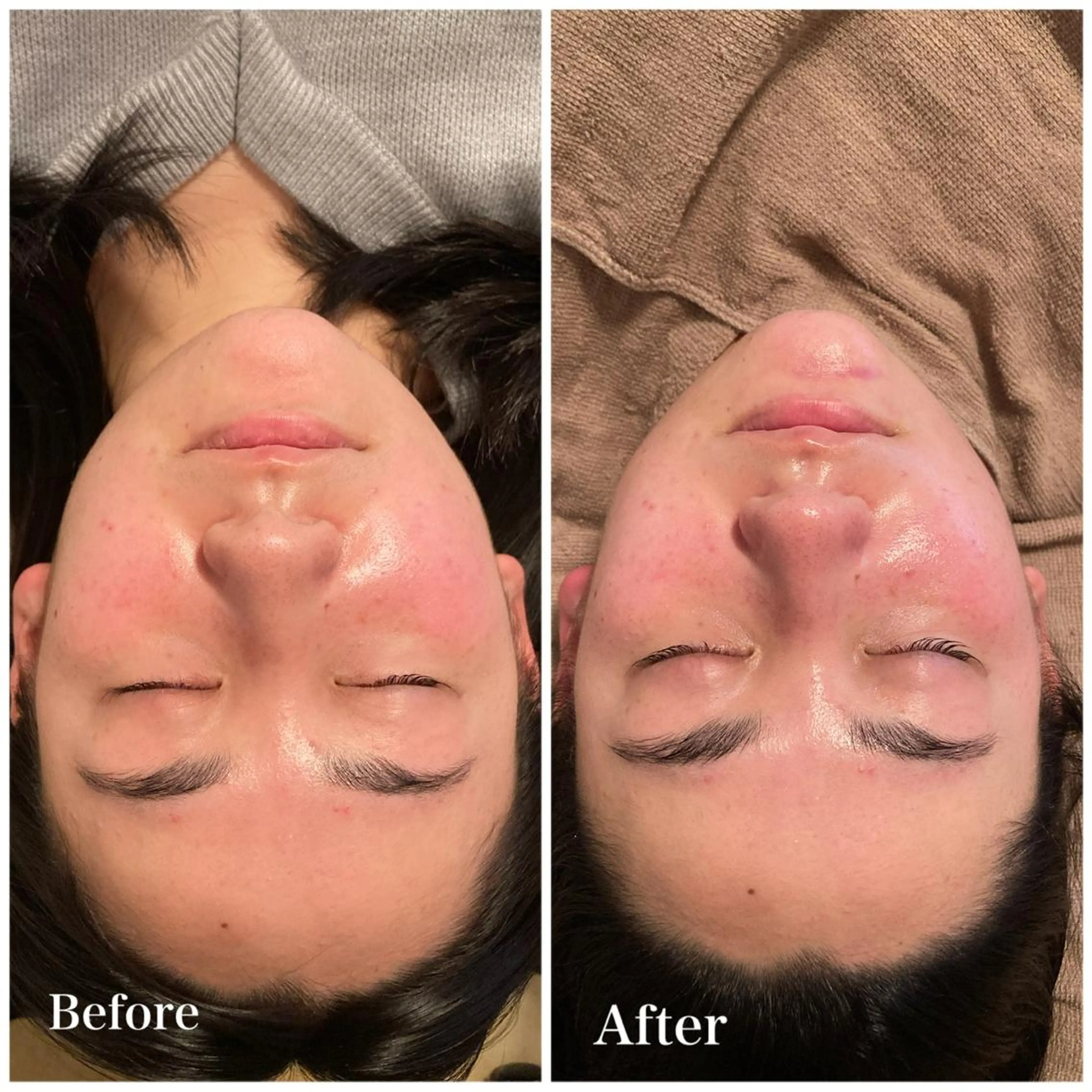 Ｂ&H所属・頭痛肩こり改善/小顔 サロンB&H心斎橋のエステ・リラクイメージ