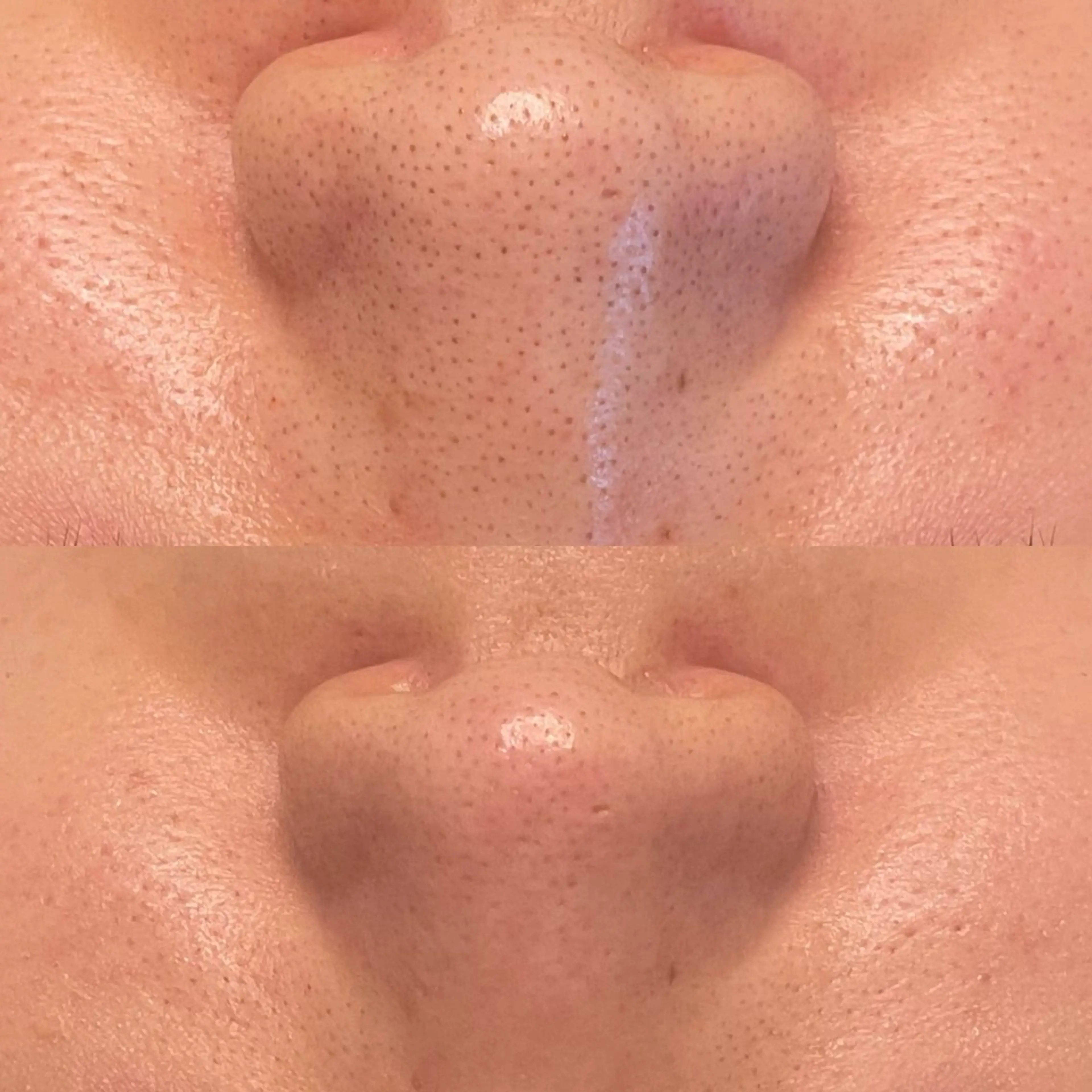 エステ private saloneclatのその他イメージ