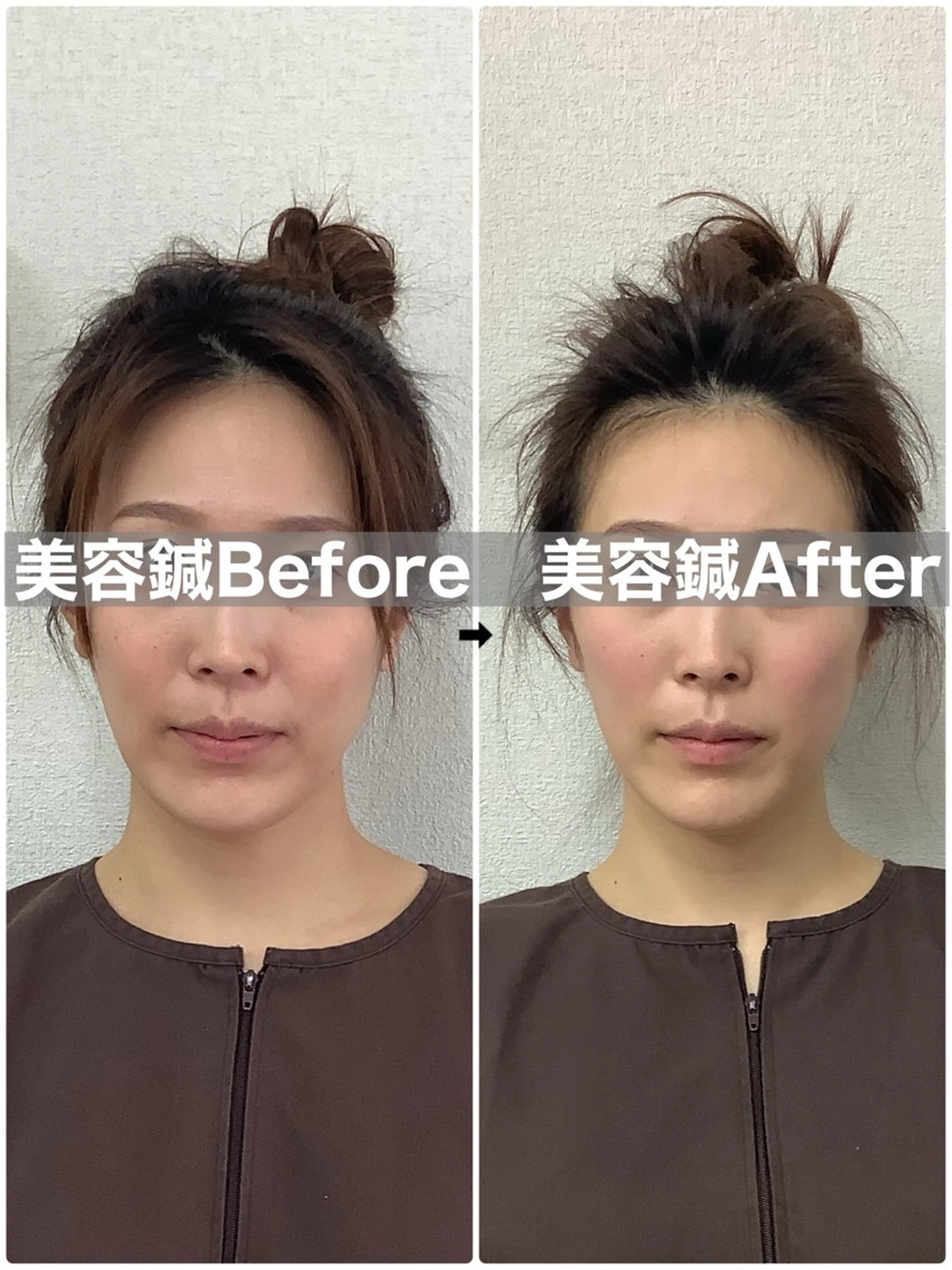 エステ リラク ハリサロンドオフ 美容鍼灸×小顔整体のエステ・リラクイメージ