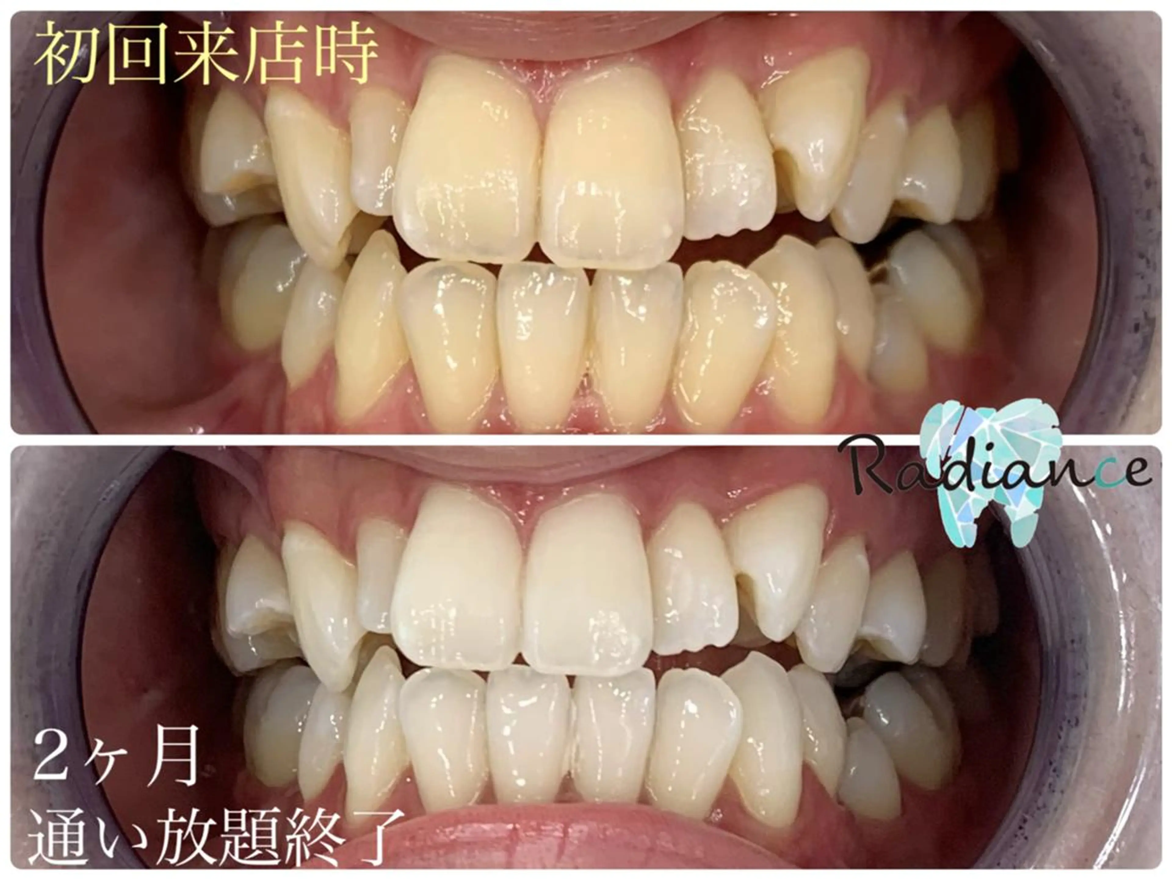 札幌ホワイトニング ラディアンス菊水店のその他イメージ