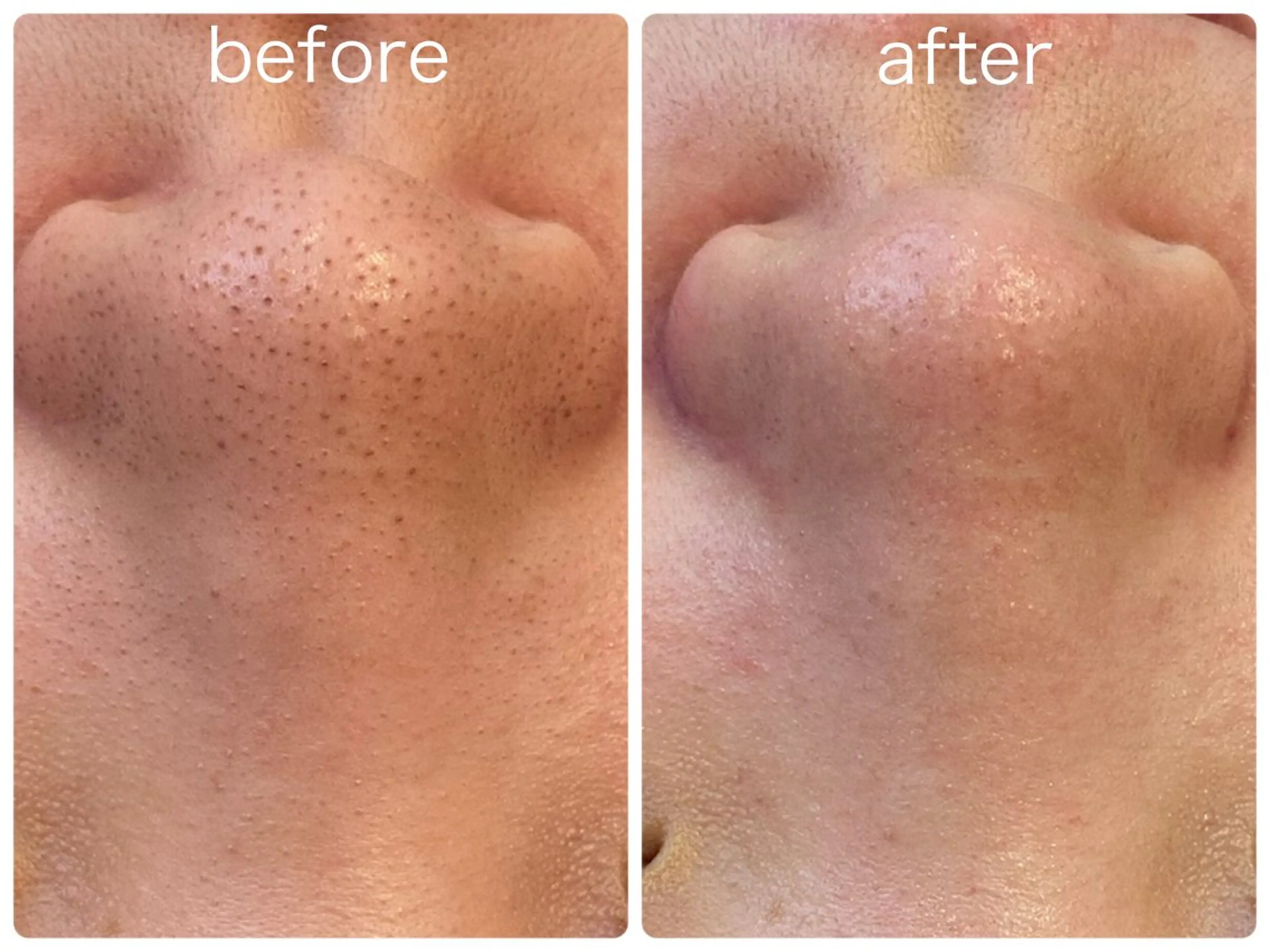 エステ Hisui 小出のエステ・リラクイメージ