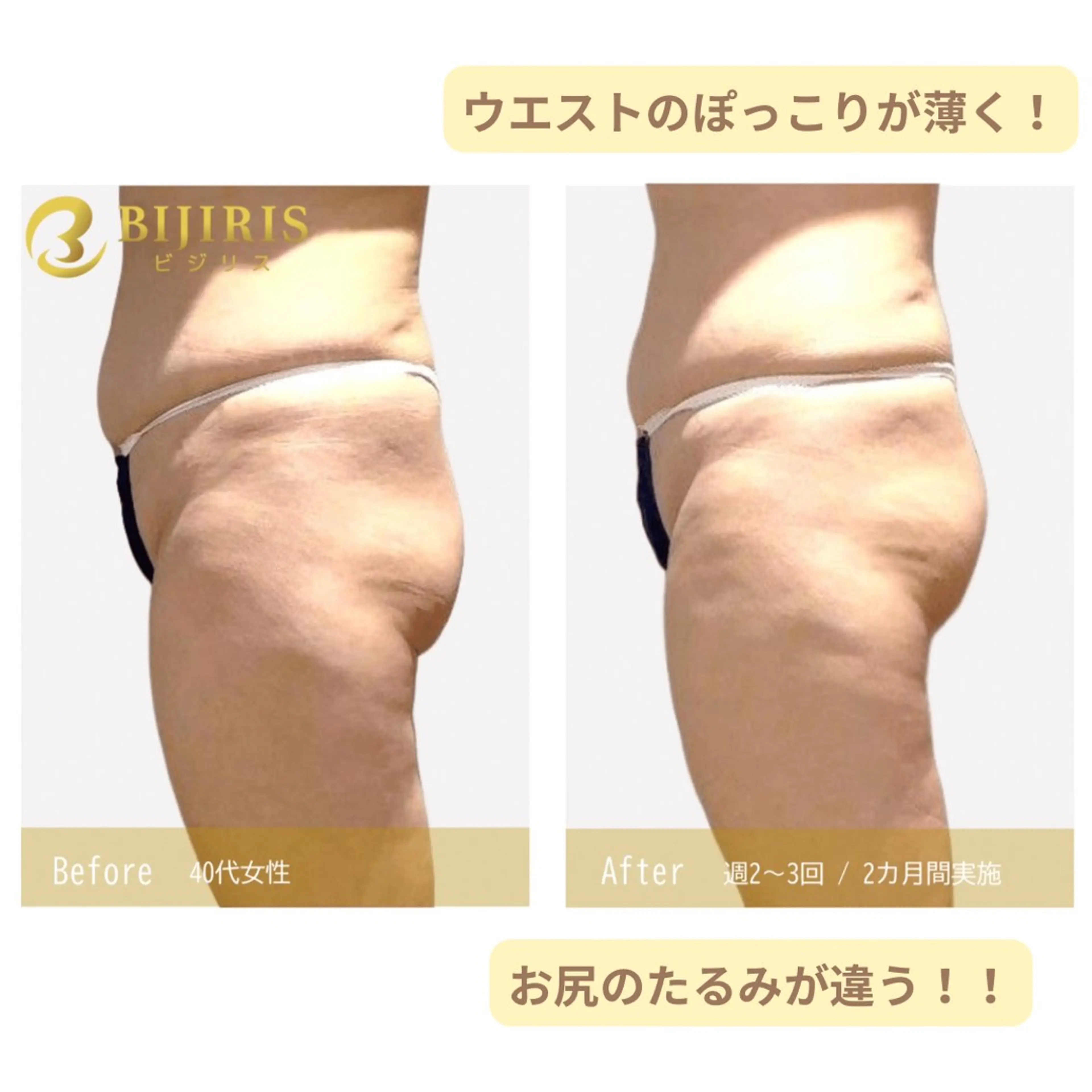 セルフ脱毛/美尻イス キングスサロン熊本のエステ・リラクイメージ