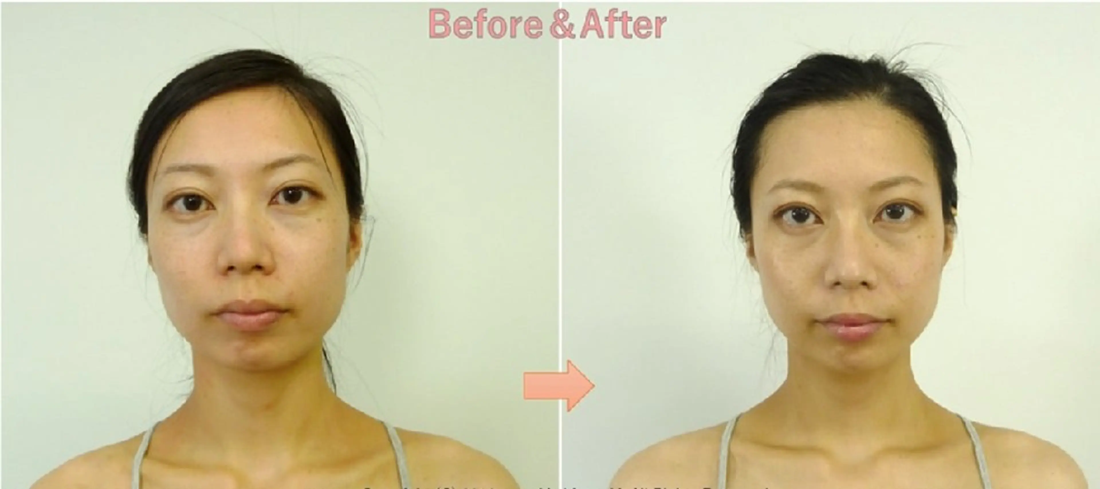 美容整体サロン DOLCE のエステ・リラクイメージ