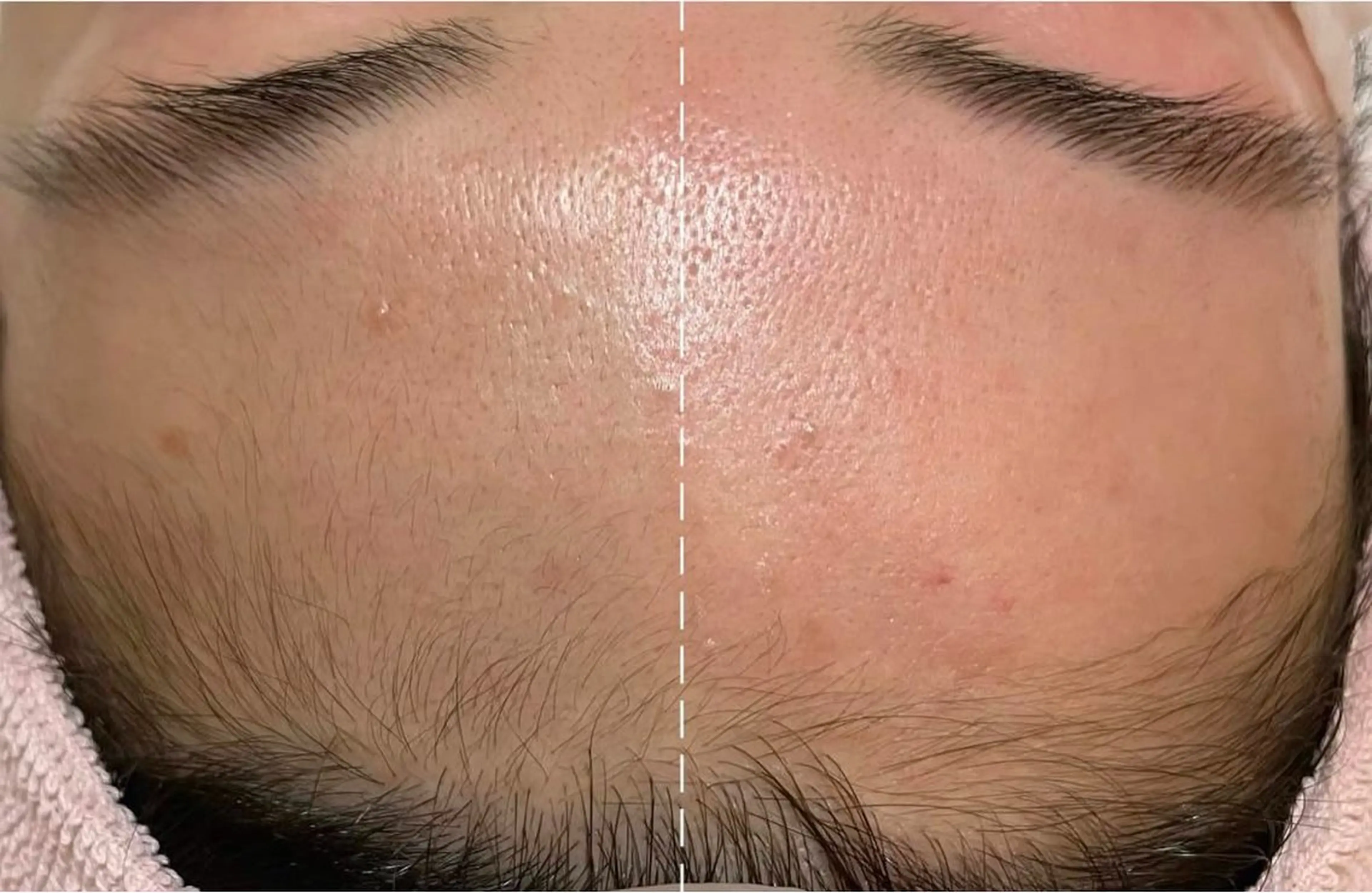 リピーター続出❣️肌が光る艶肌フェイシャルwax💕の写真