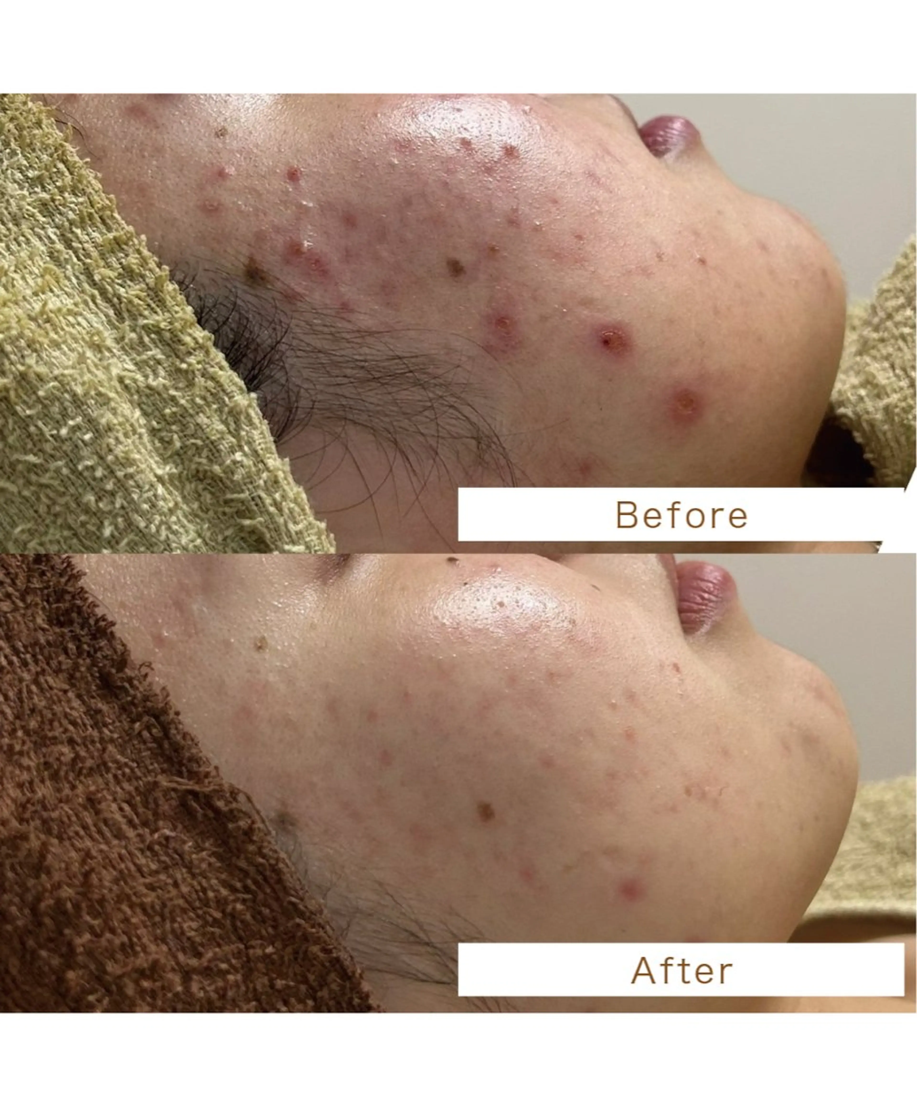 エステサロン .BX新人スタッフのエステ・リラクイメージ