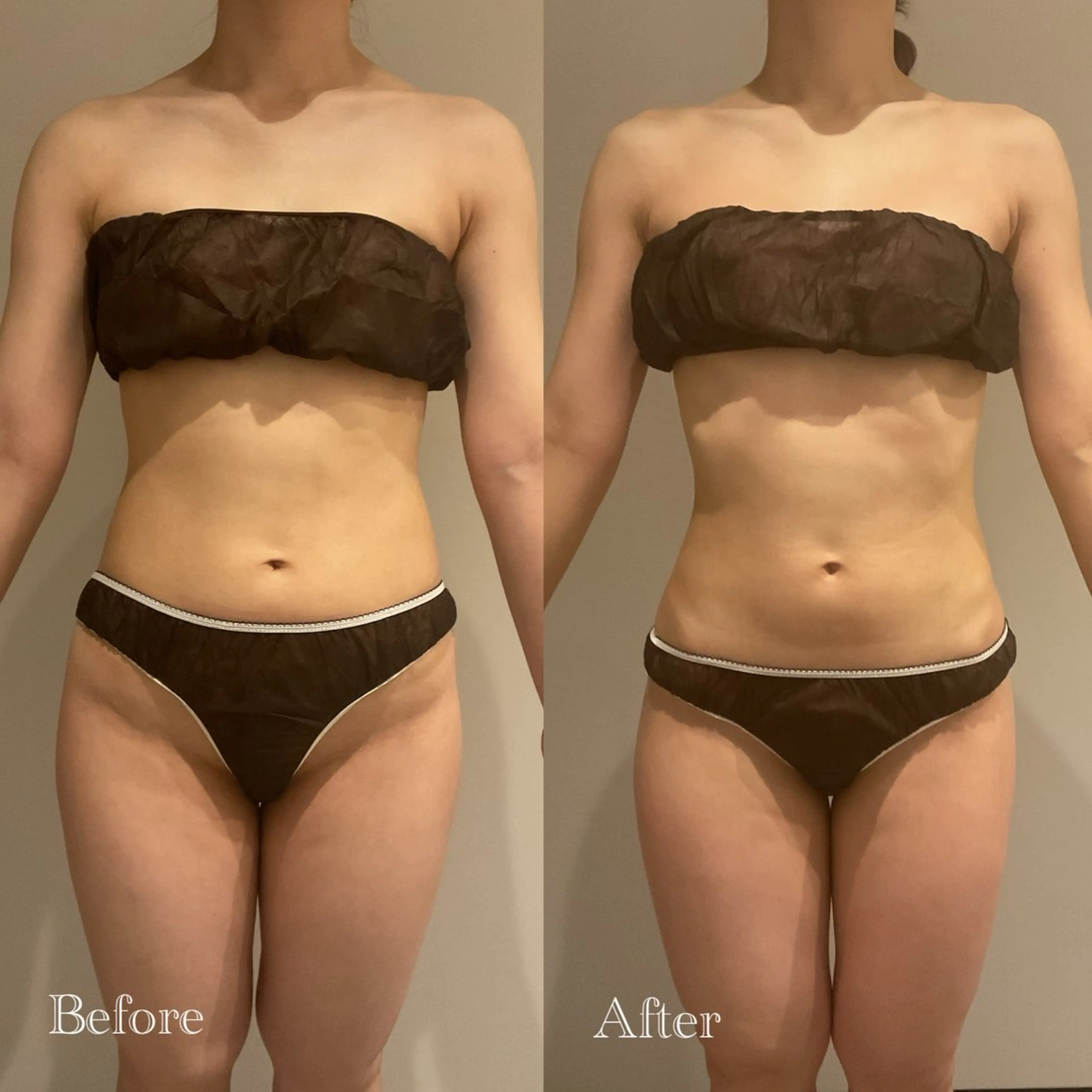 Esthetic MiEUXのエステ・リラクイメージ