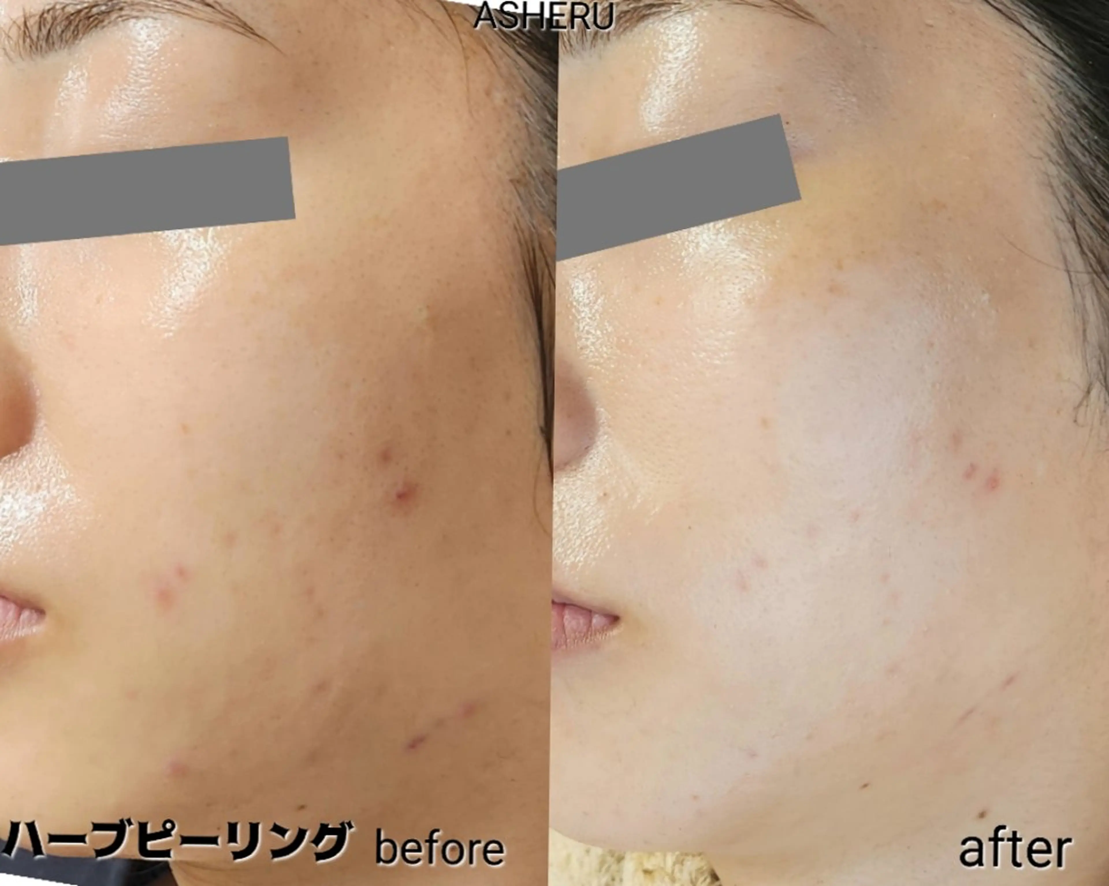 エステ ASHERU* Yuiのエステ・リラクイメージ