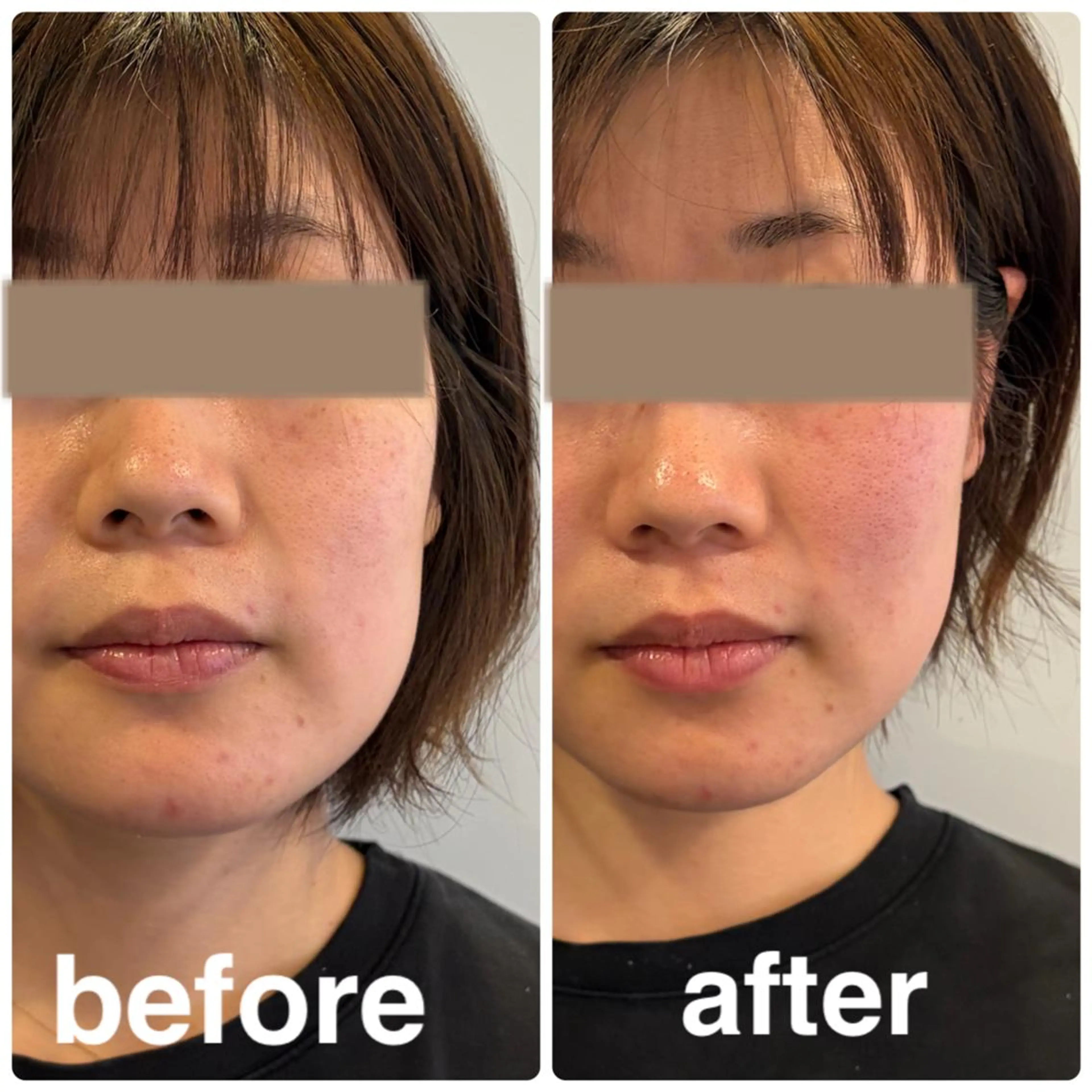 小顔矯正/整体師 丸山綾野のその他イメージ