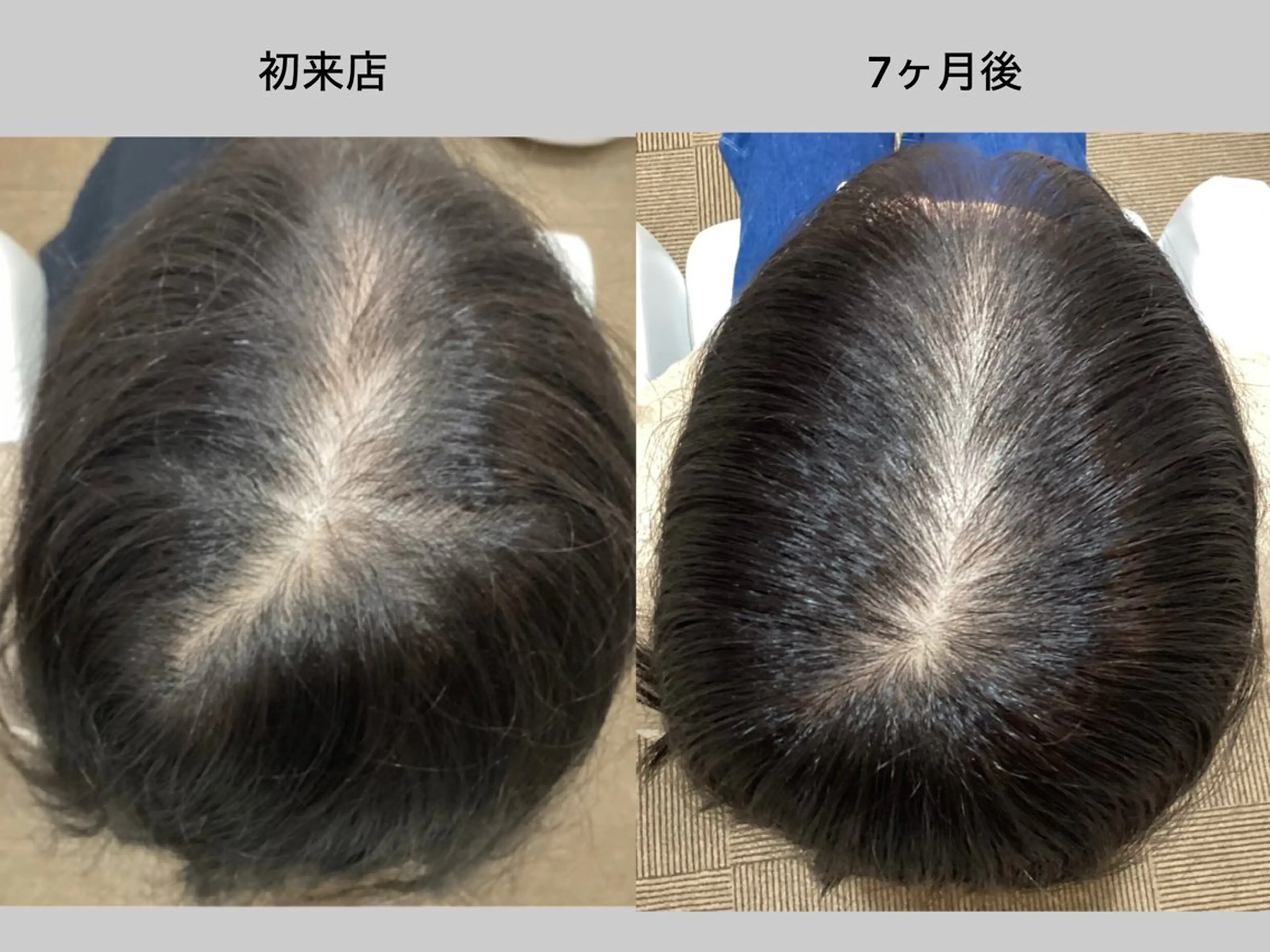 L+ 育毛発毛サロン秋葉原のエステ・リラクイメージ