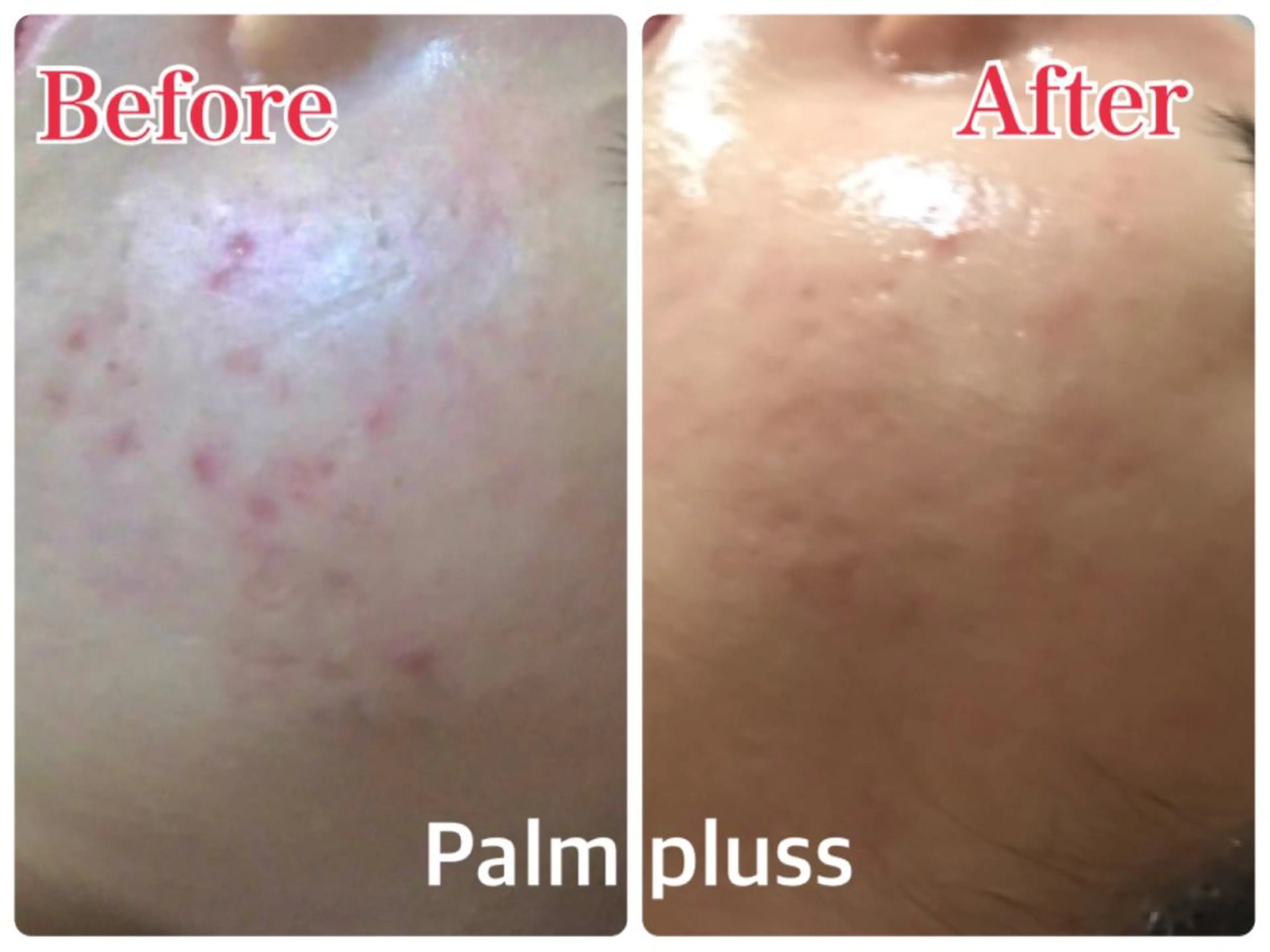 首肩こり専門サロン Kalnicco/カルニッコ所属・Kalnicco (カルニッコ)のエステ・リラクイメージ