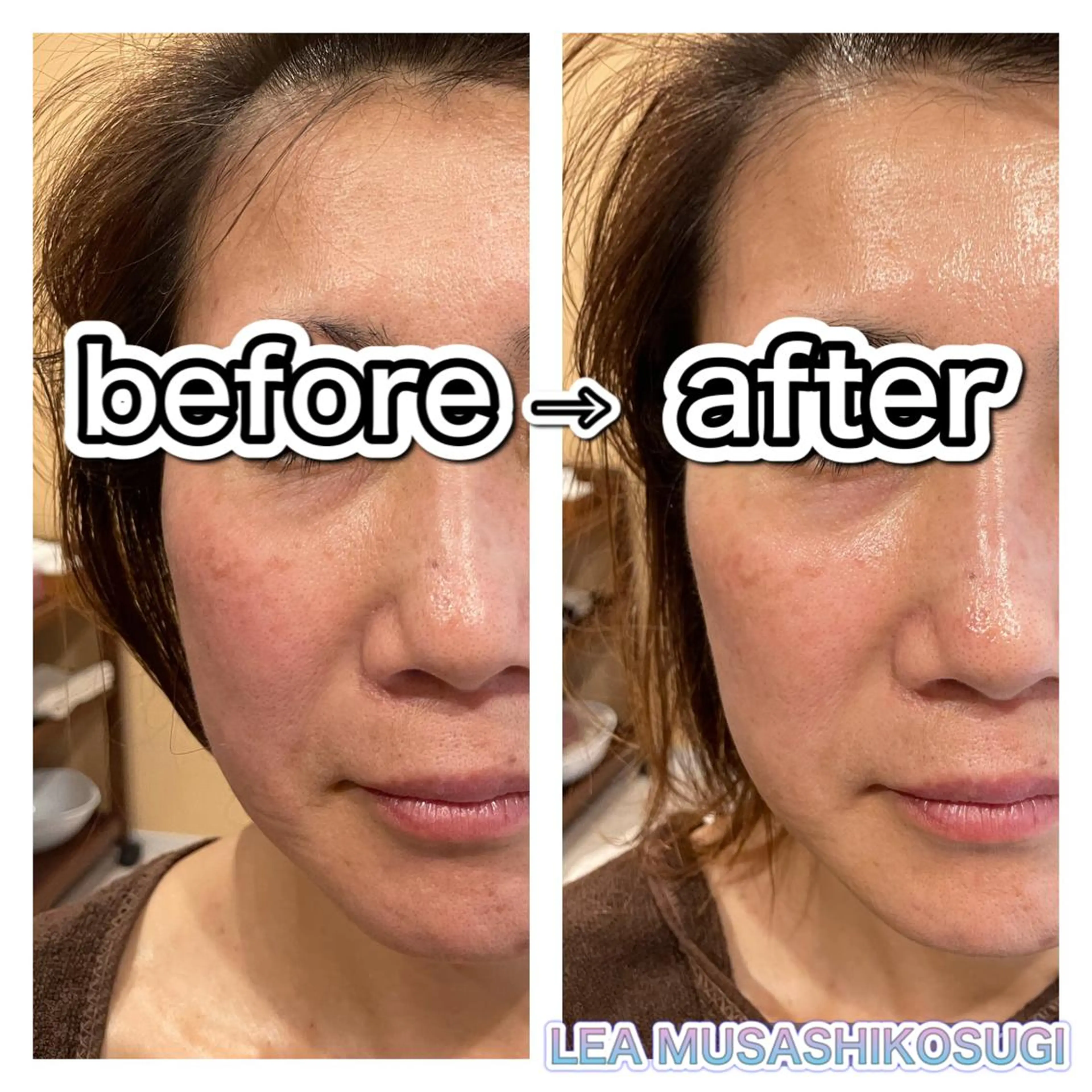 美肌育成サロン LEA武蔵小杉のエステ・リラクイメージ