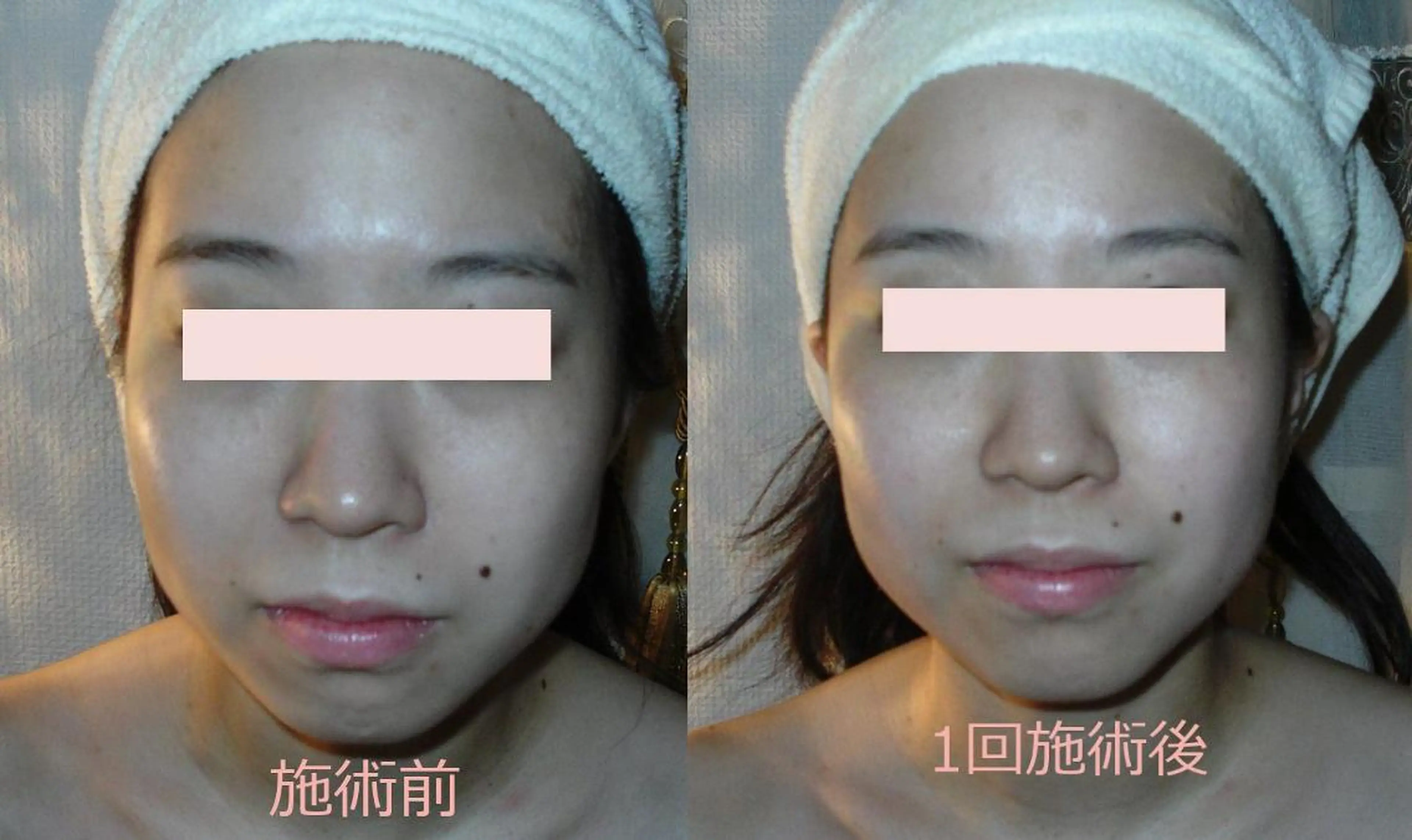 エステ リラク genese beauteのエステ・リラクイメージ