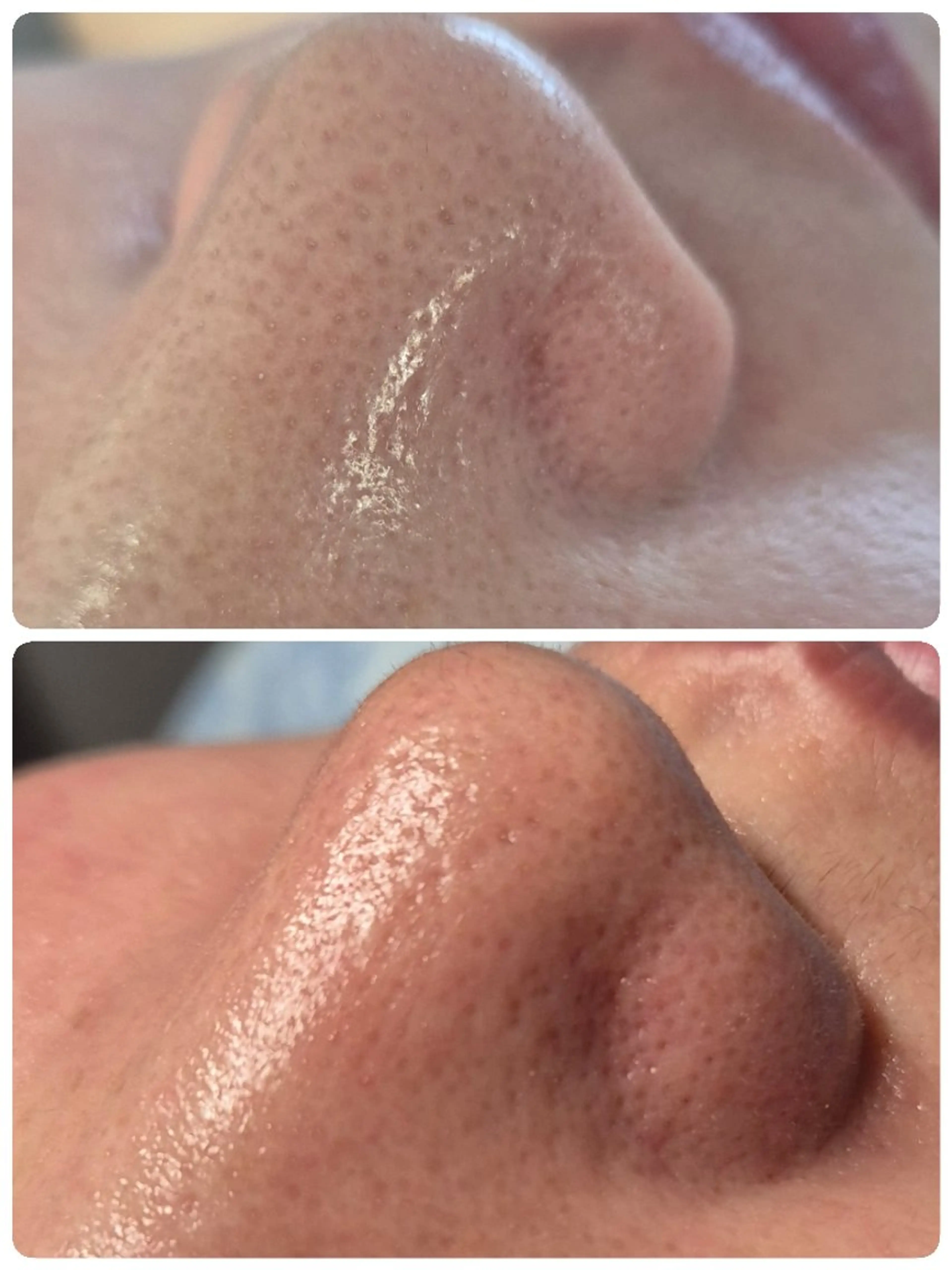 エステ REH2O Rihoのエステ・リラクイメージ