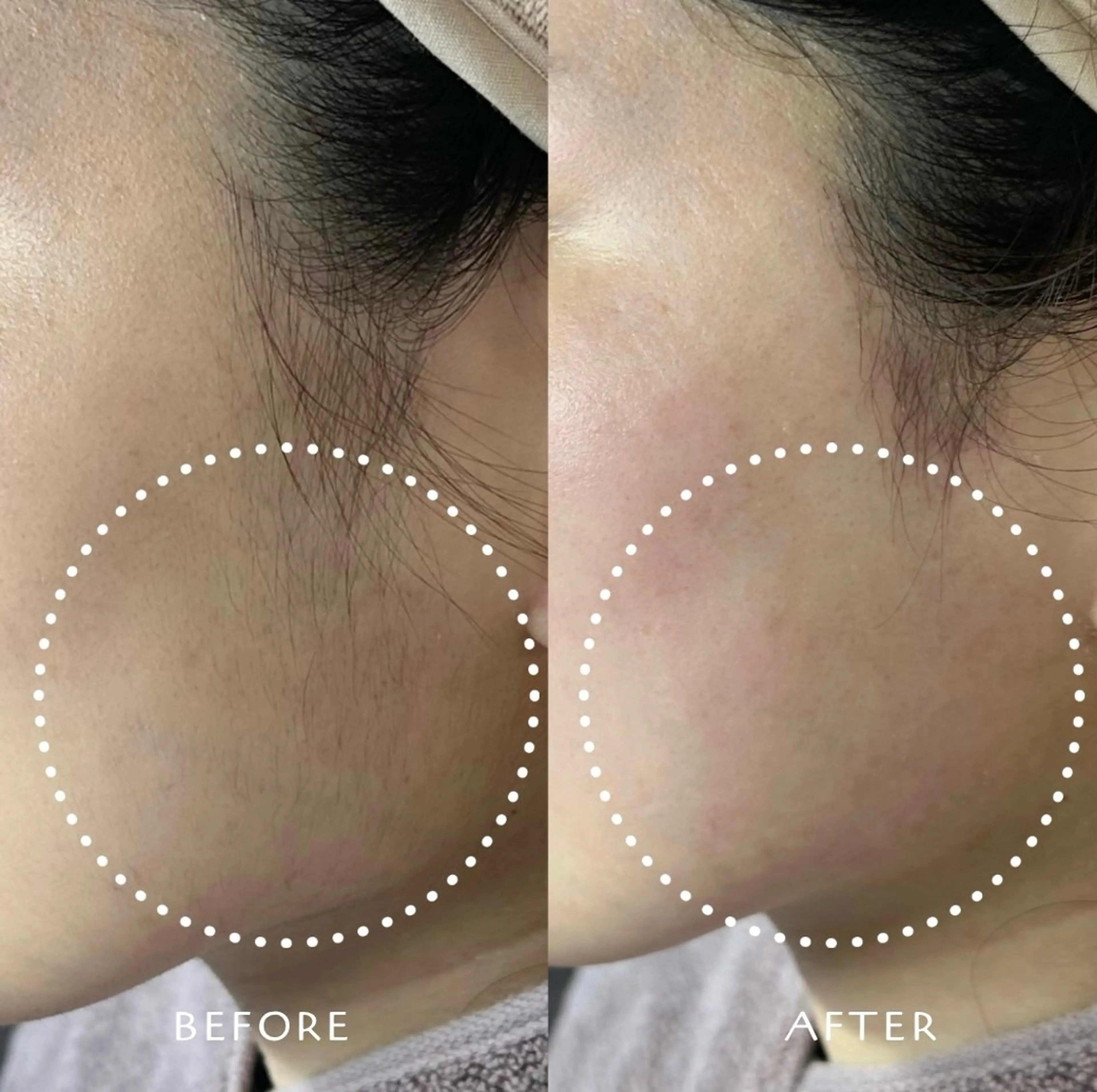 フェイシャルワックス KANAKOのエステ・リラクイメージ