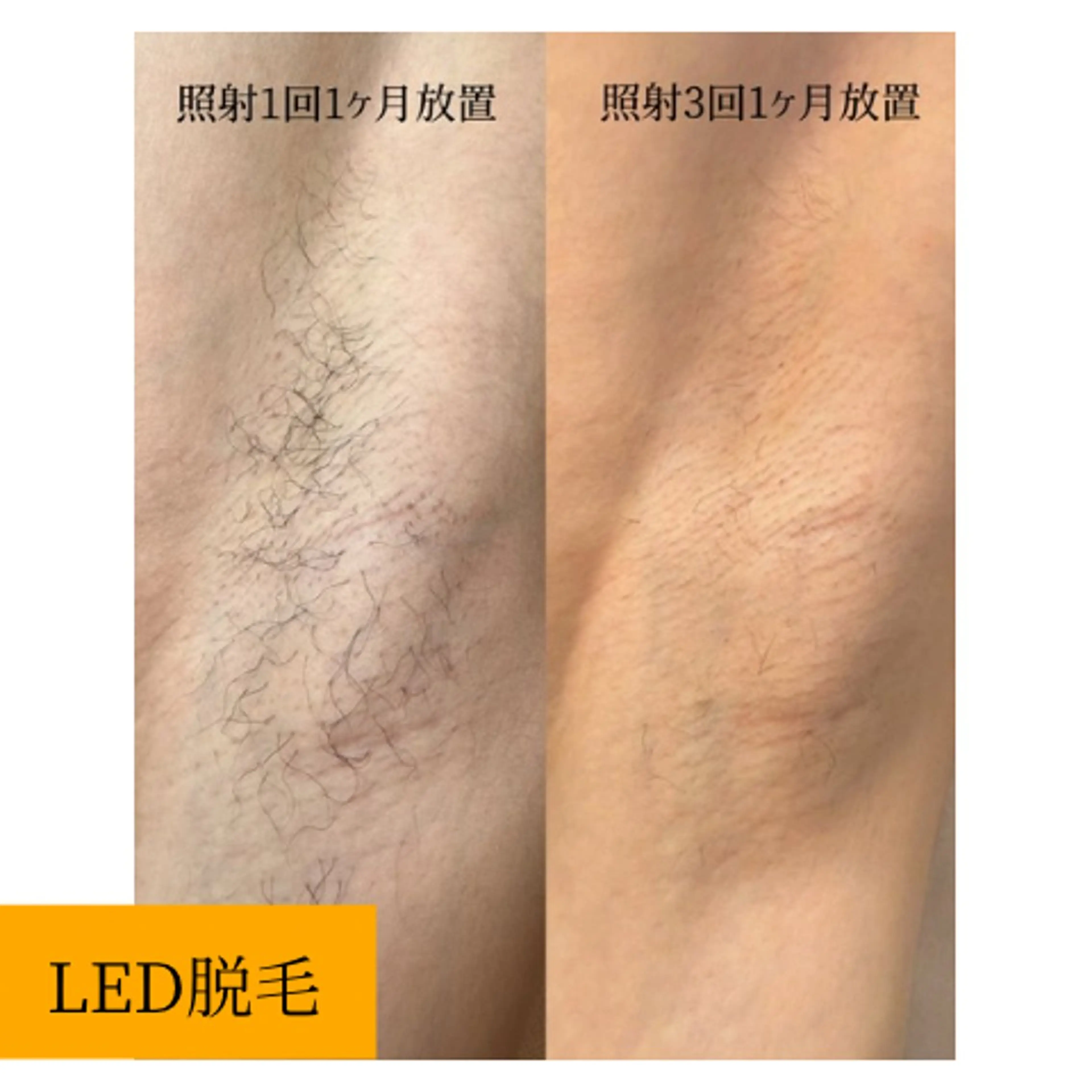 viv　春日部/豊春 megumiのエステ・リラクイメージ