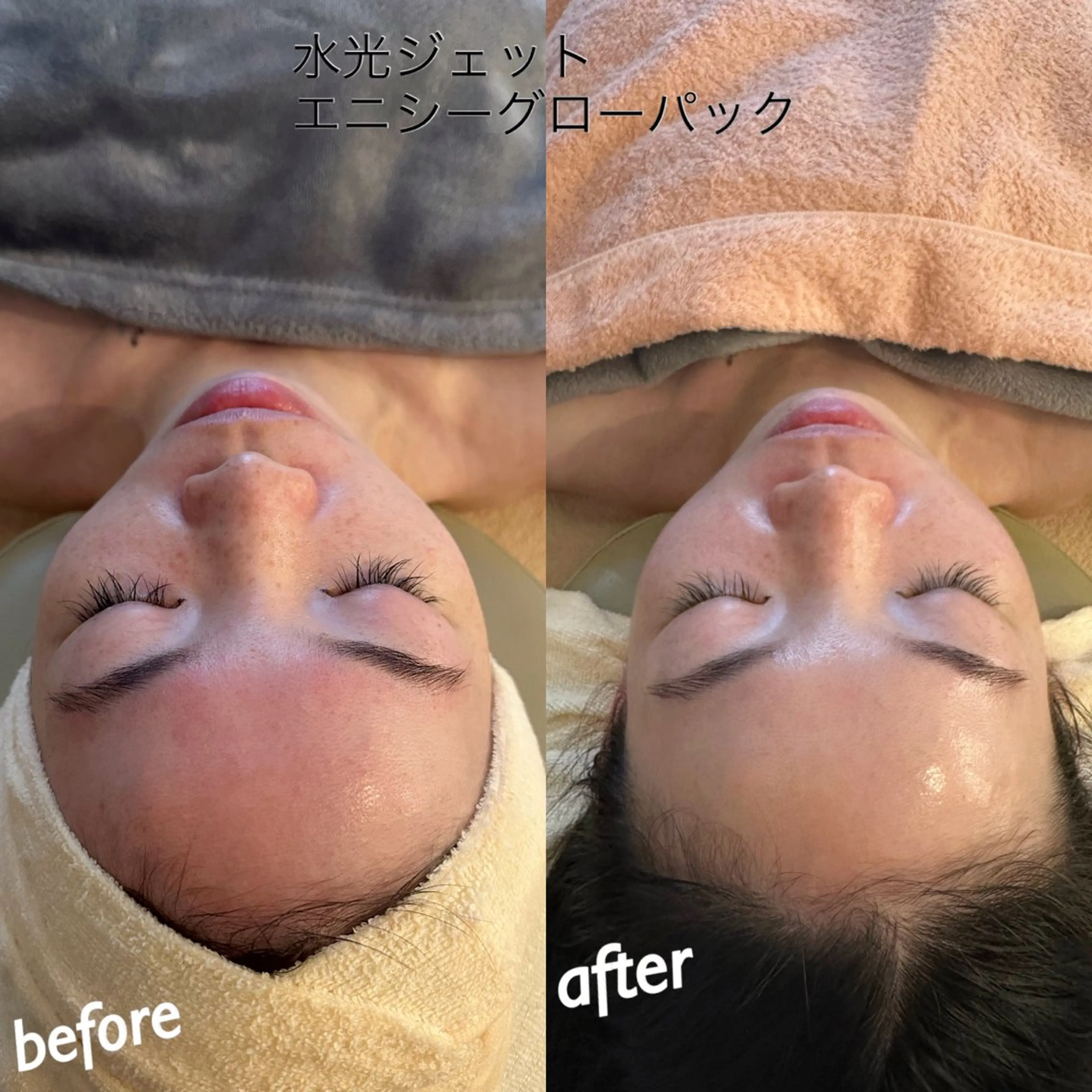 エステ うなじ脱毛/美肌脱毛 LABELのエステ・リラクイメージ