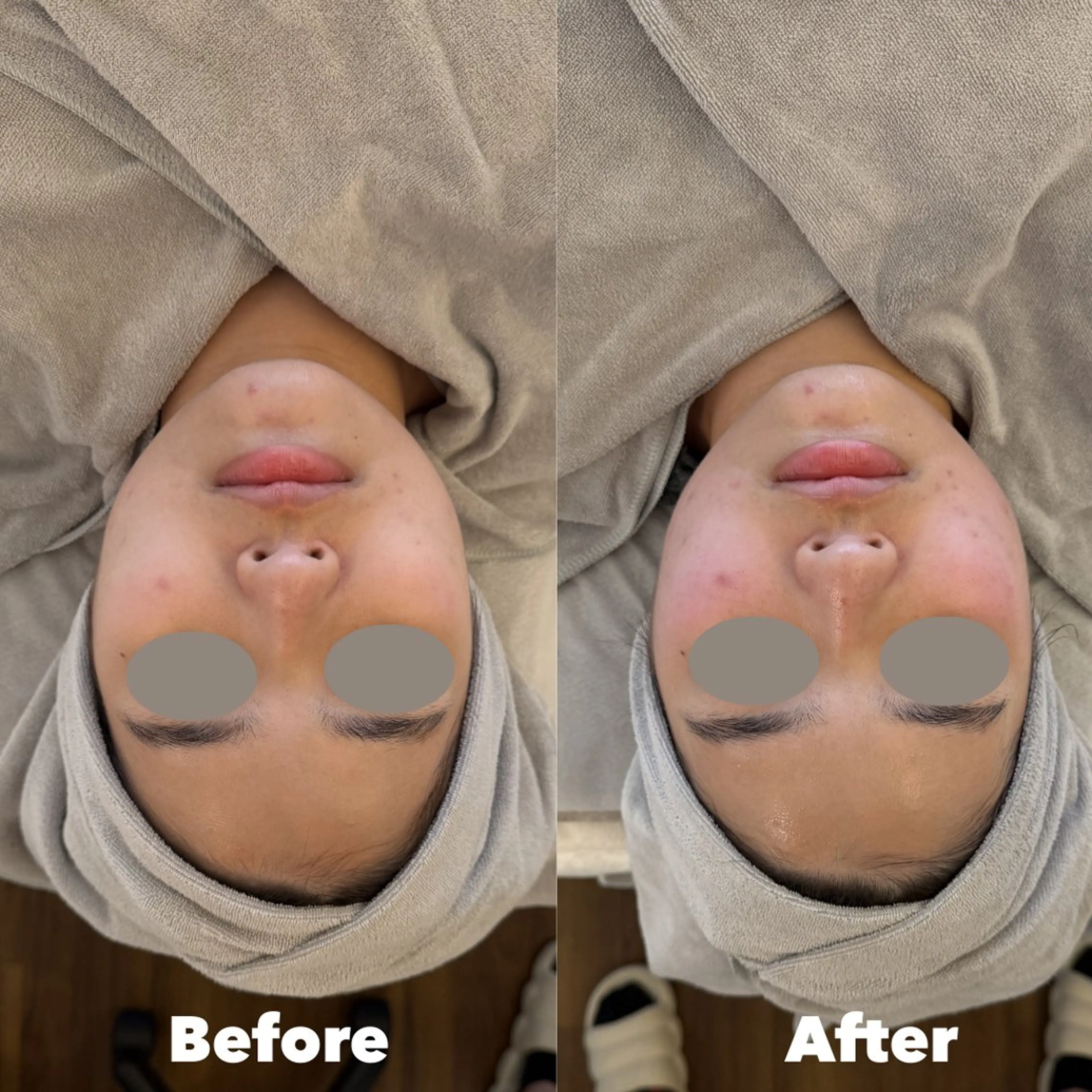 エステ 恵比寿 オンダリフト 小顔ケアのその他イメージ