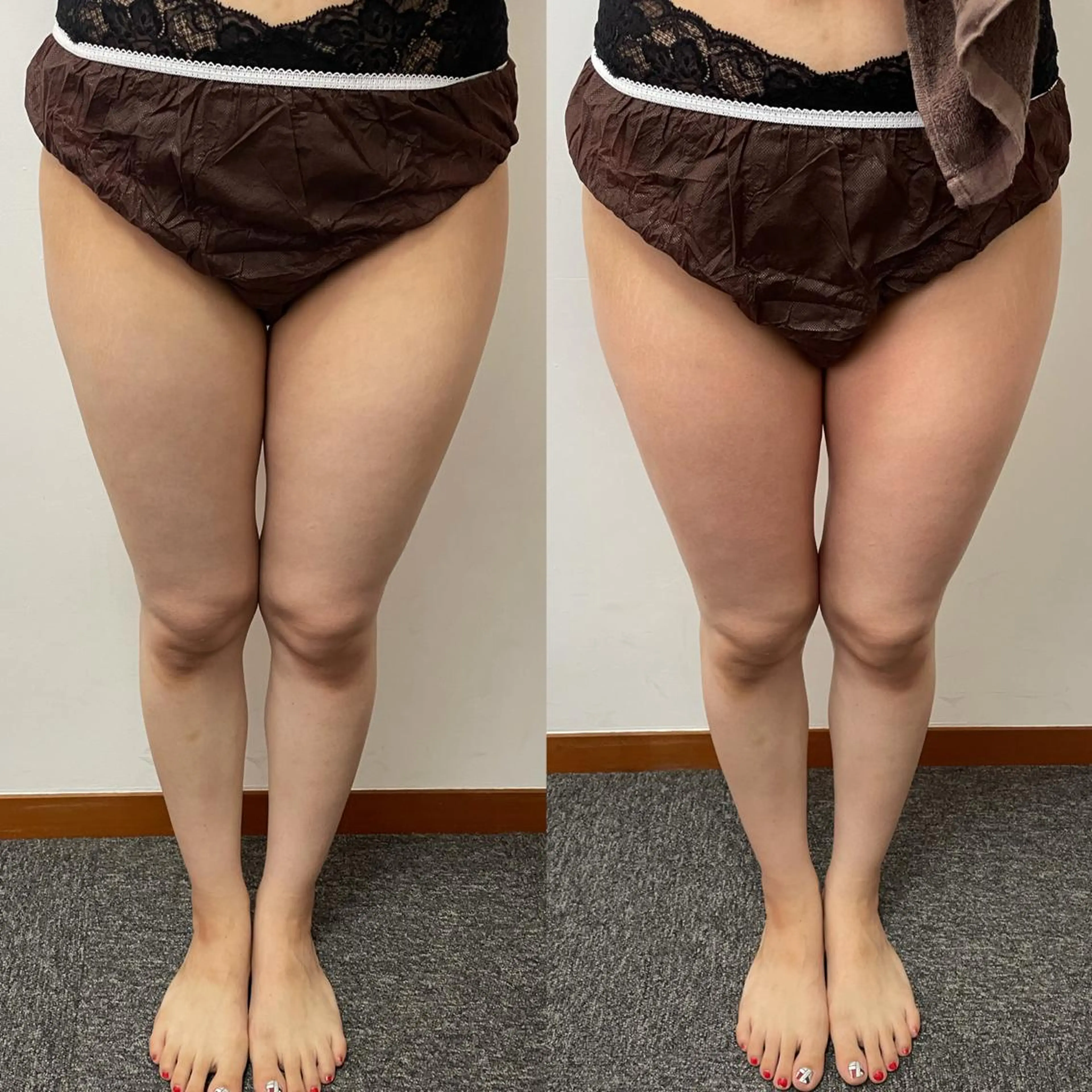 エステ Baby Angel ／marinのマツエク・マツパデザイン