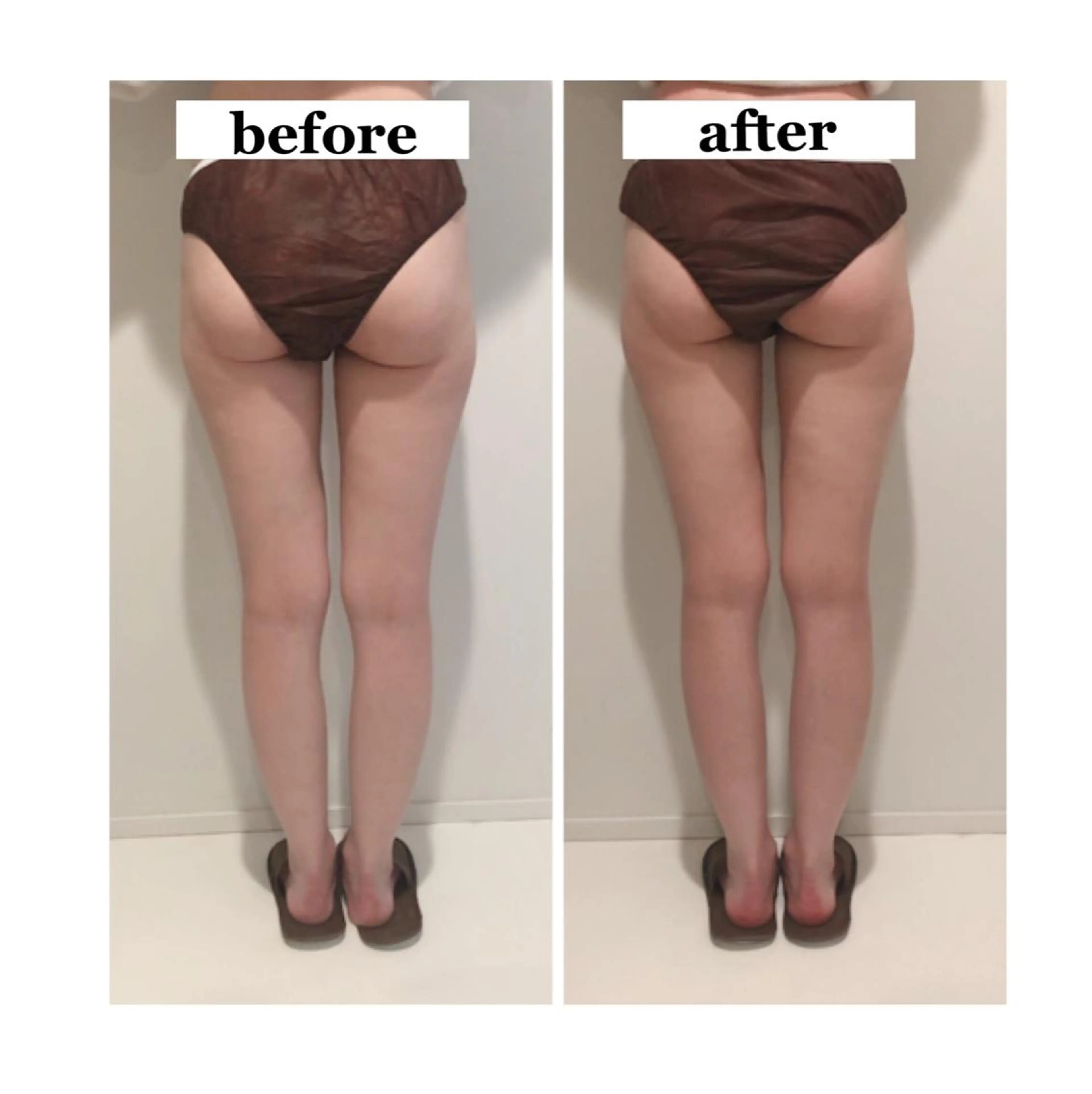 日本一ムクミがとれる salon Flotのエステ・リラクイメージ