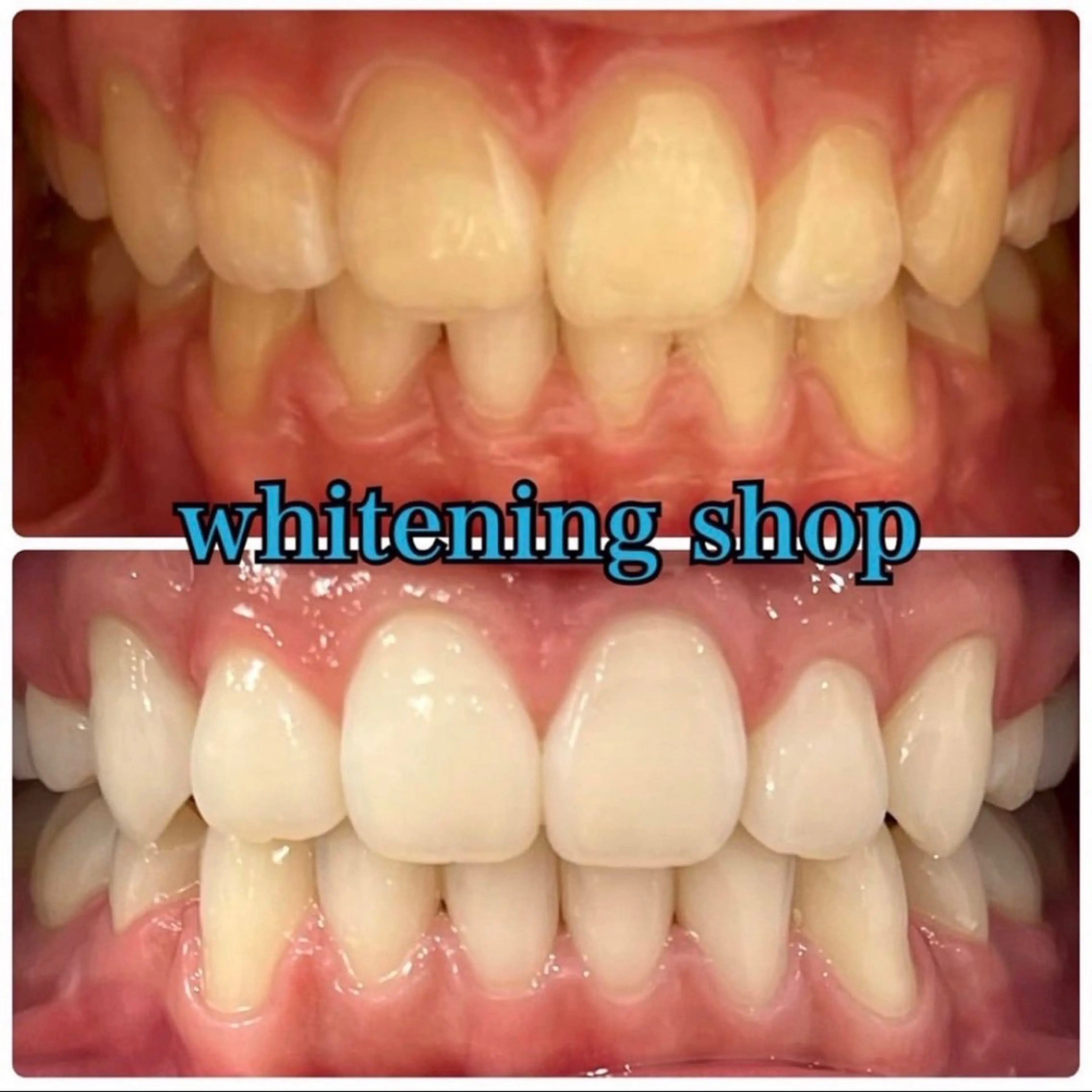 ホワイトニング ショップ吉祥寺店のエステ・リラクイメージ