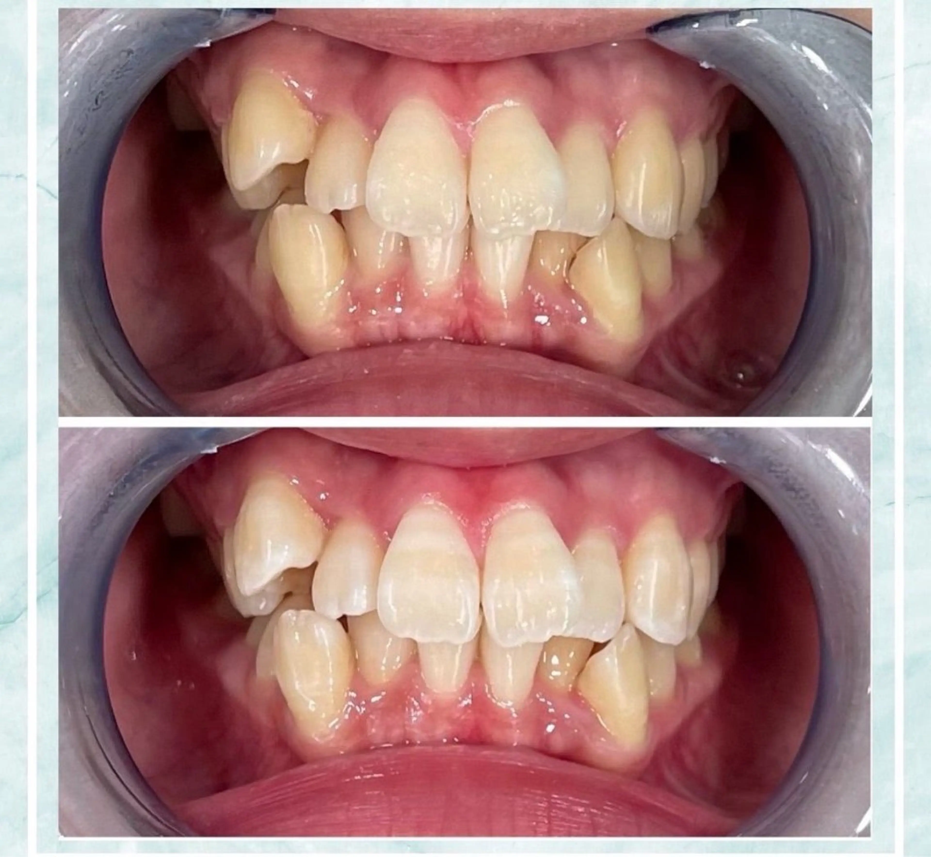 その他 ホワイトニング ビューティ名古屋栄のその他イメージ