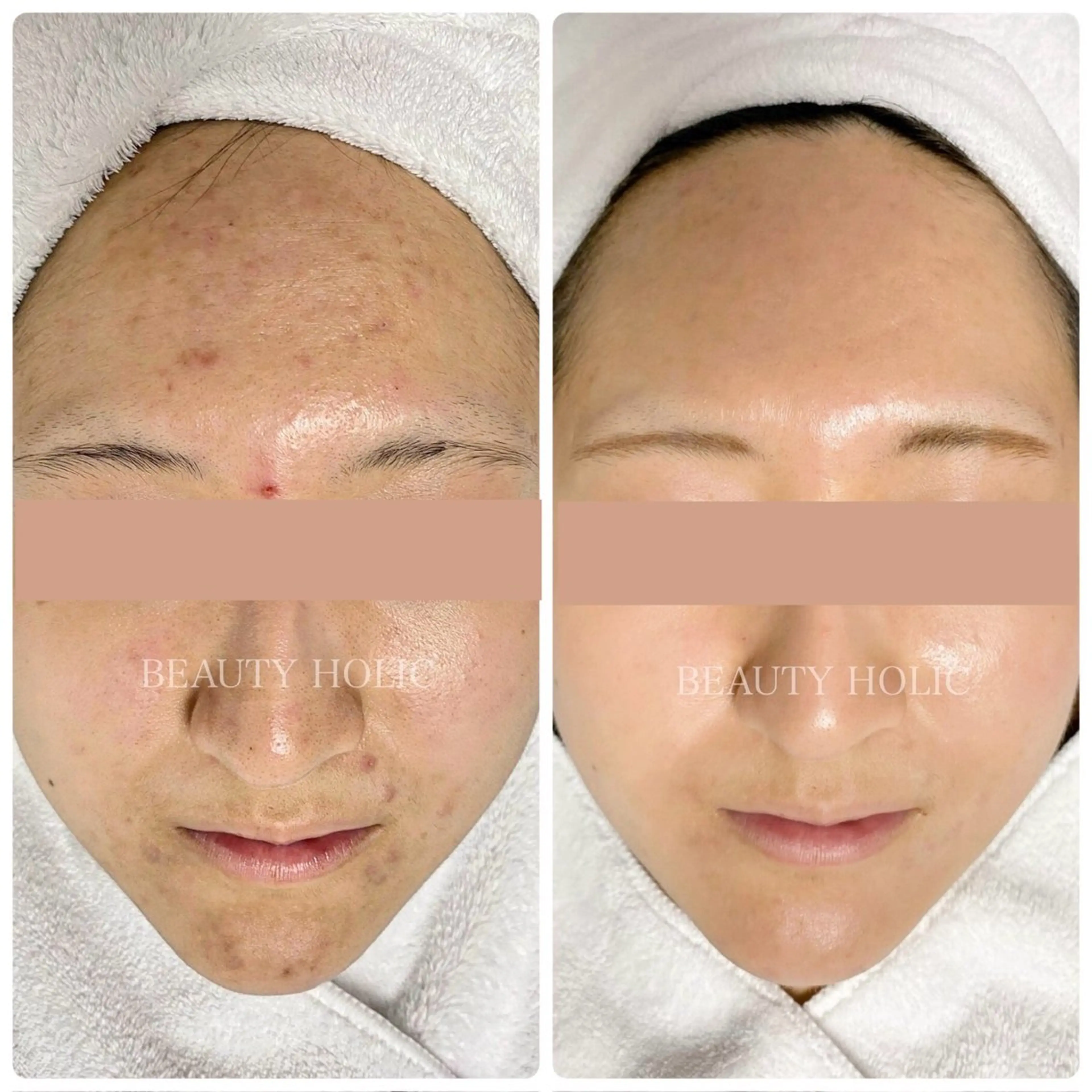 ビューティーホリック 東金店のエステ・リラクイメージ