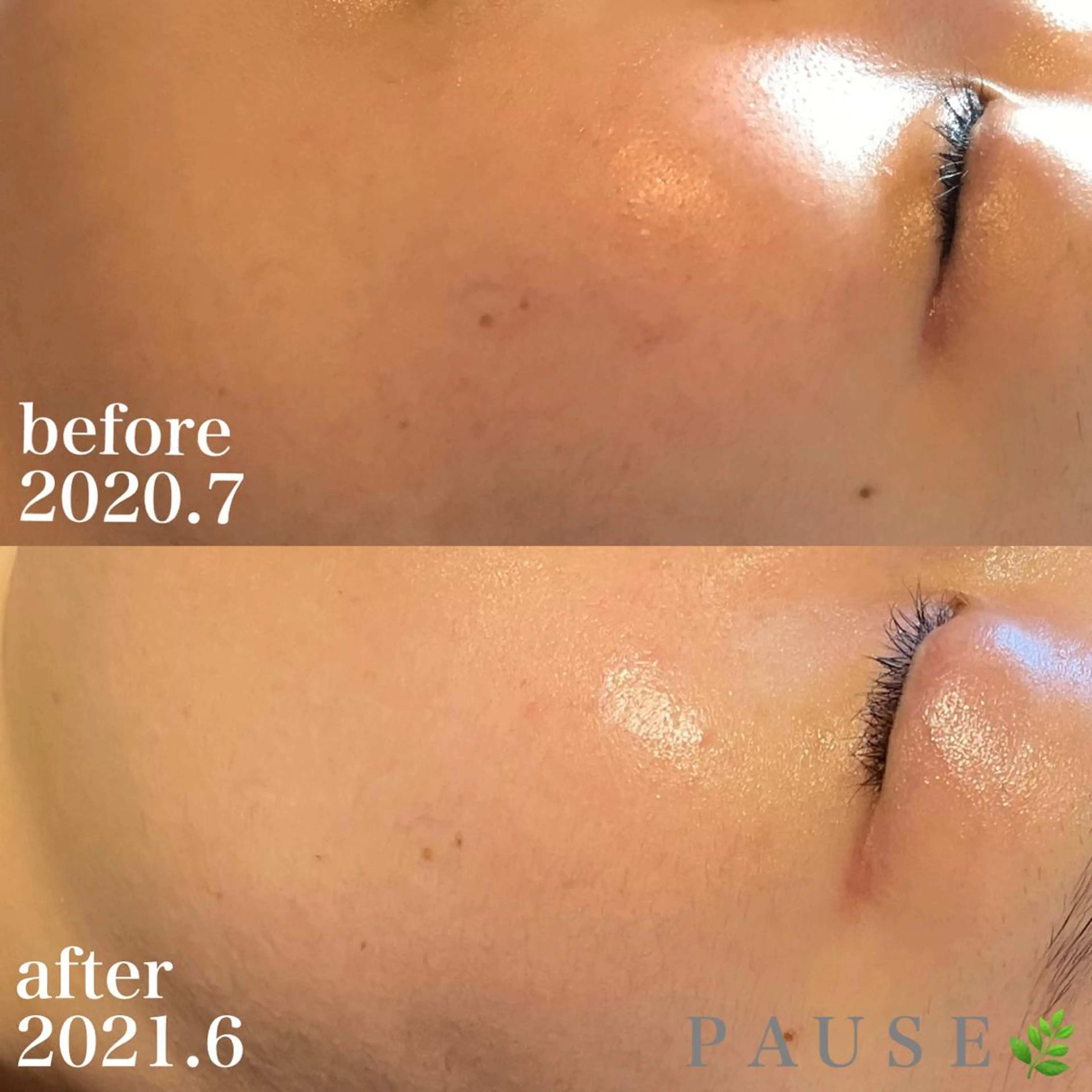 エステ 浜野 恵美のエステ・リラクイメージ