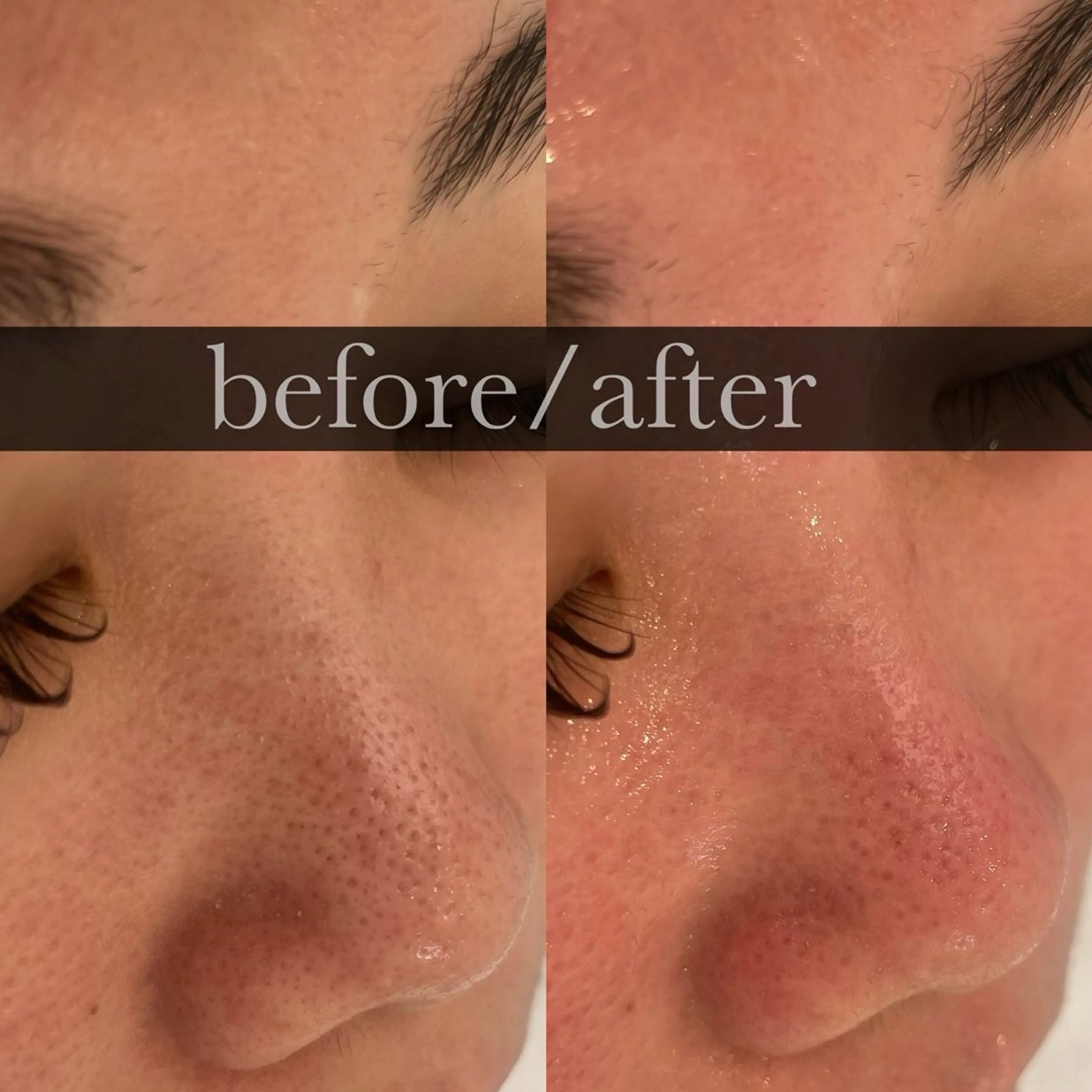 FOXYLASH inoueのエステ・リラクイメージ