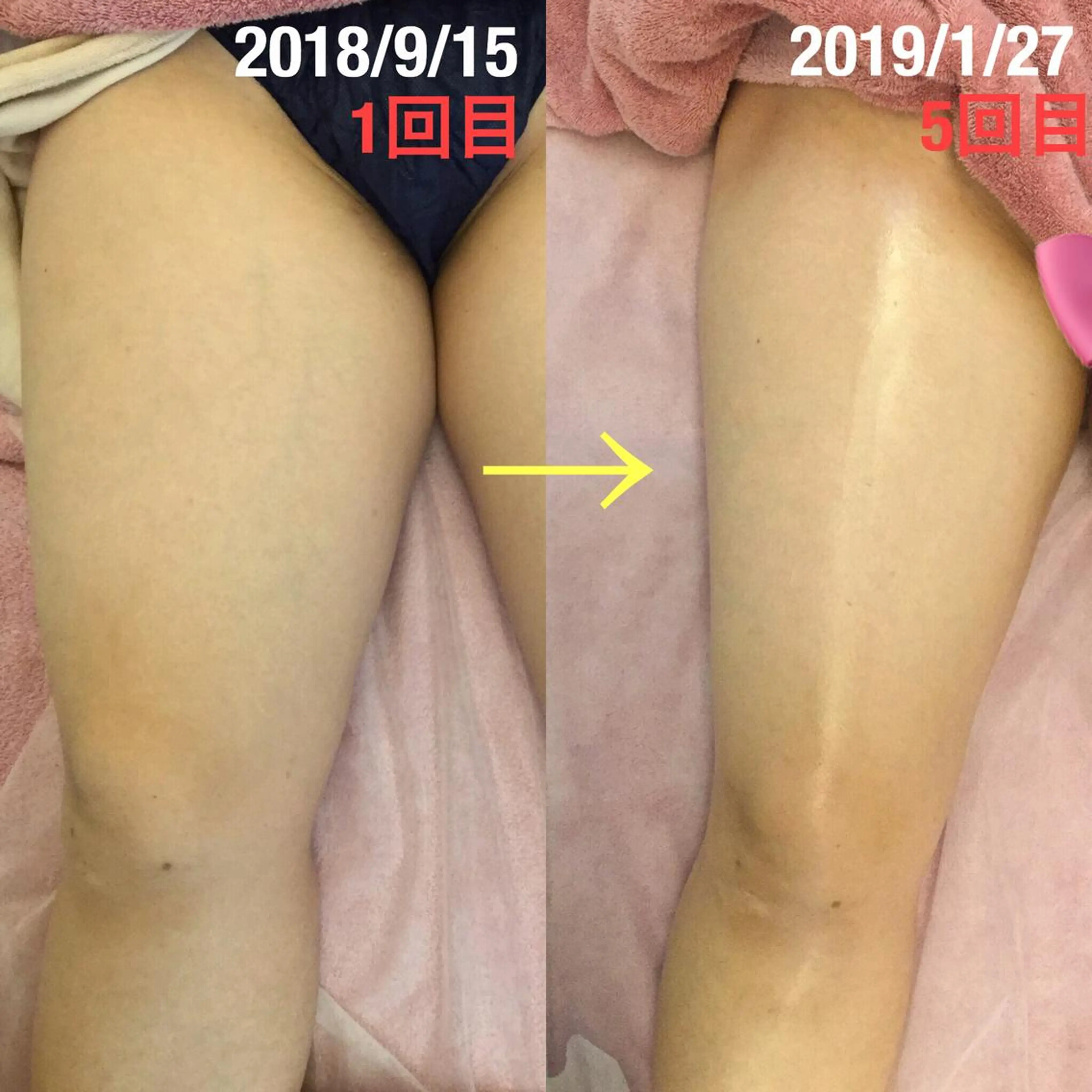 フェミニンエステ ティック大阪福島店のエステ・リラクイメージ