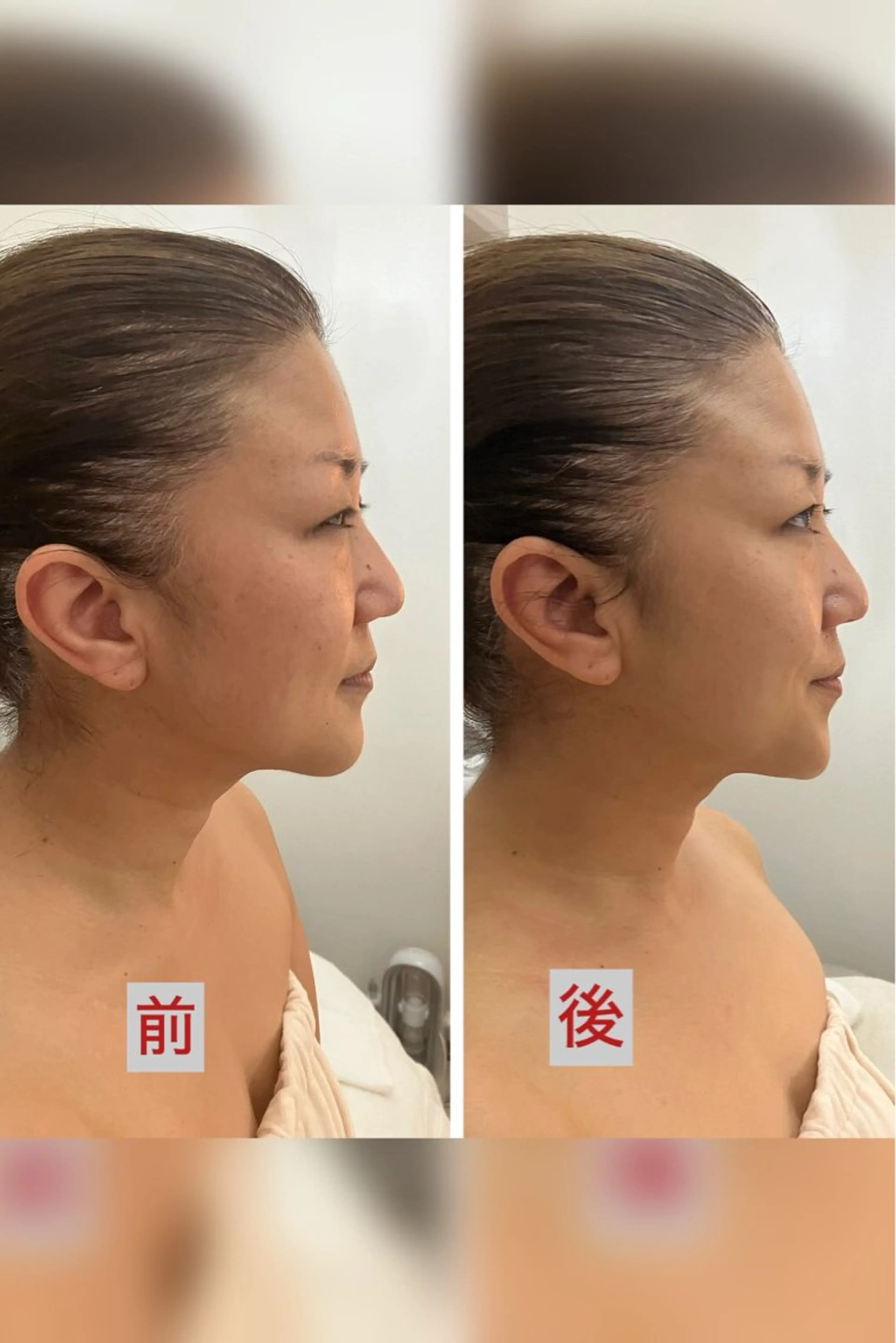 その他 たるみ改善小顔エステ 堀葉月のその他イメージ