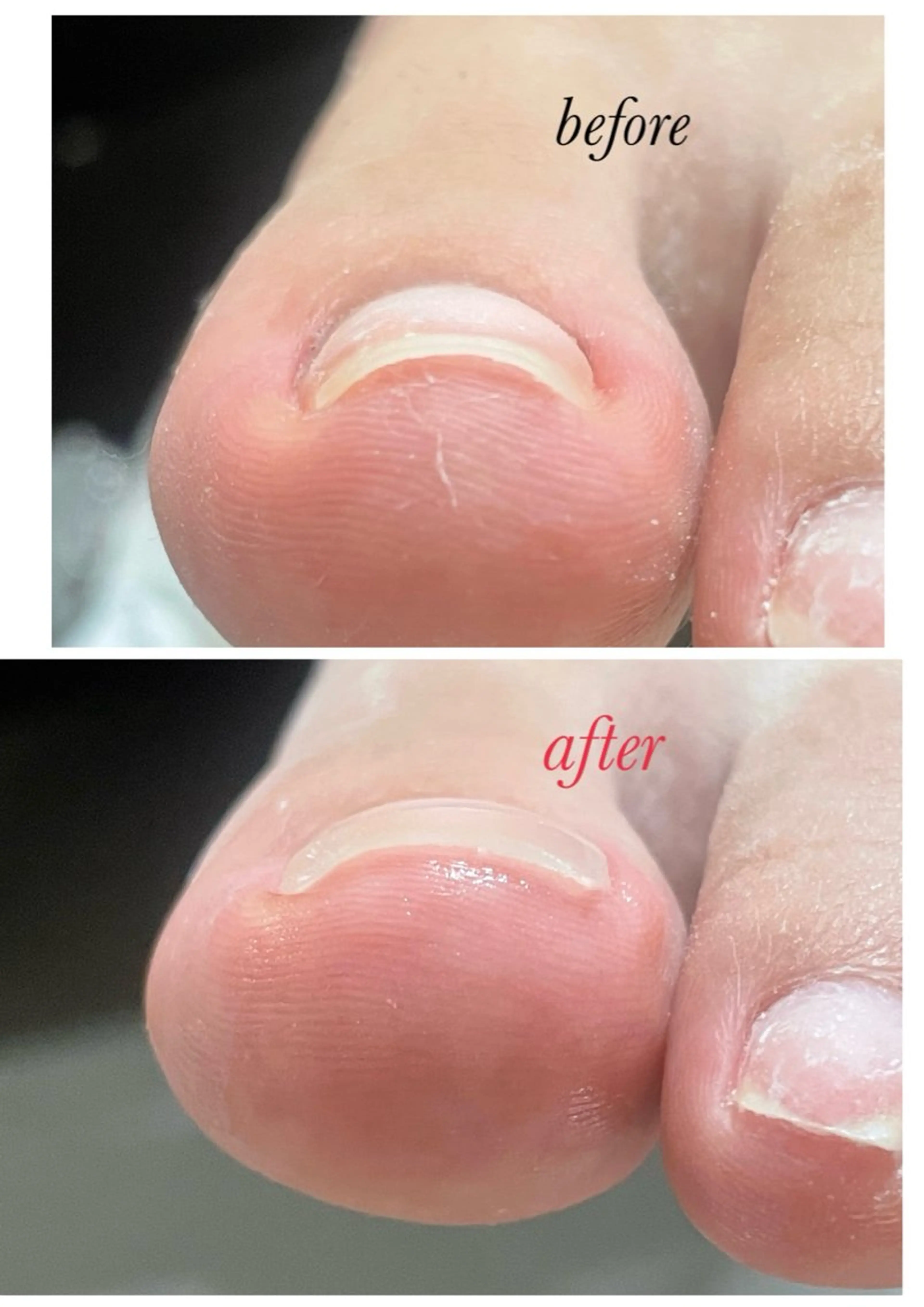 メンズ ネイル 春ネイル Chérinail 爪のお手入れのネイルデザイン