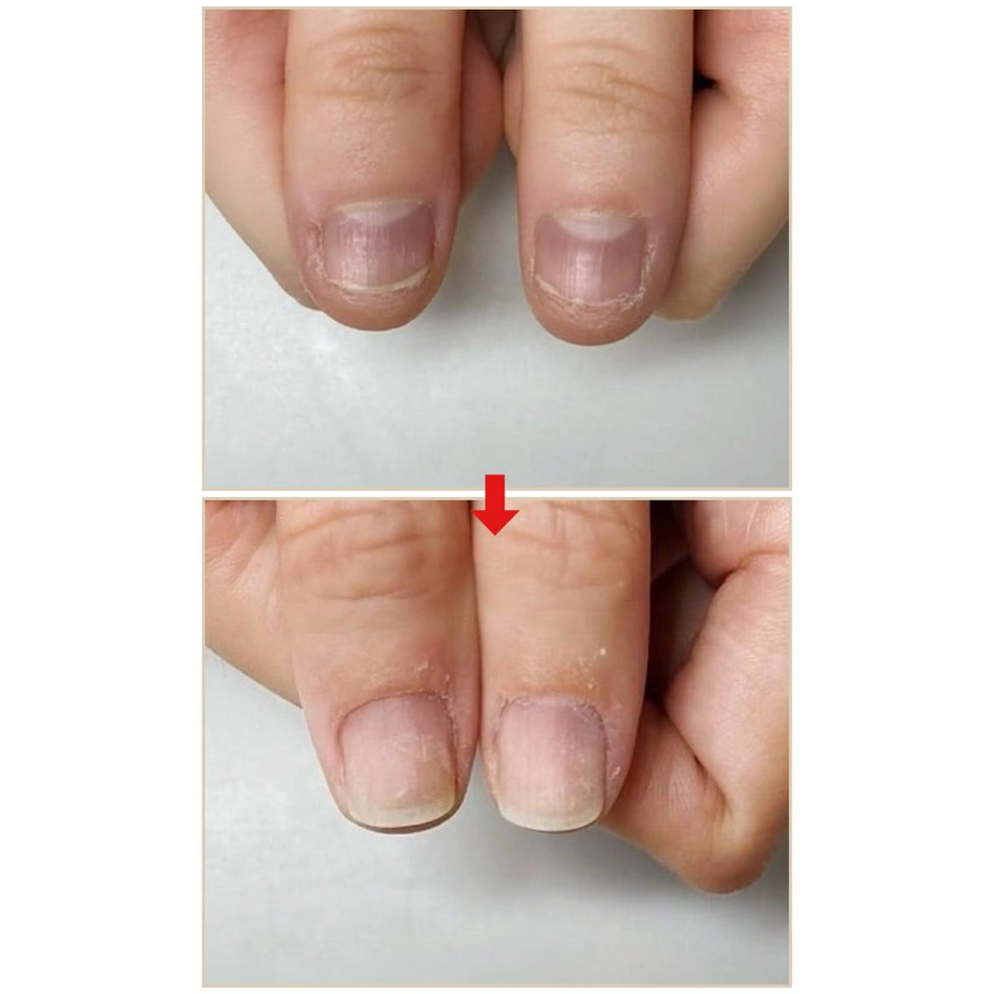 ネイル ネイルサロン アリュームのネイルデザイン