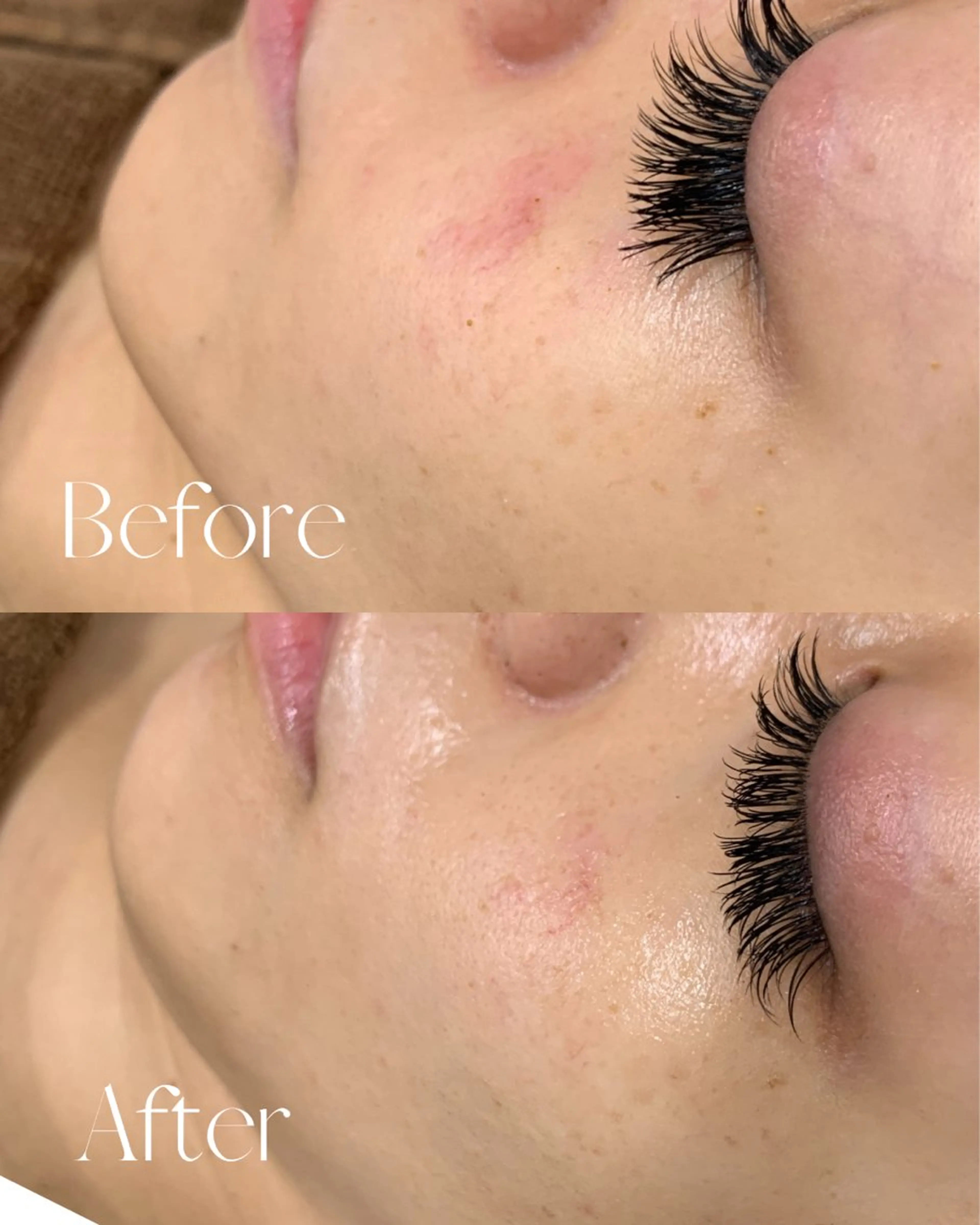 エステ シミ🩷ニキビ専門店 Matteo🎀✨のエステ・リラクイメージ