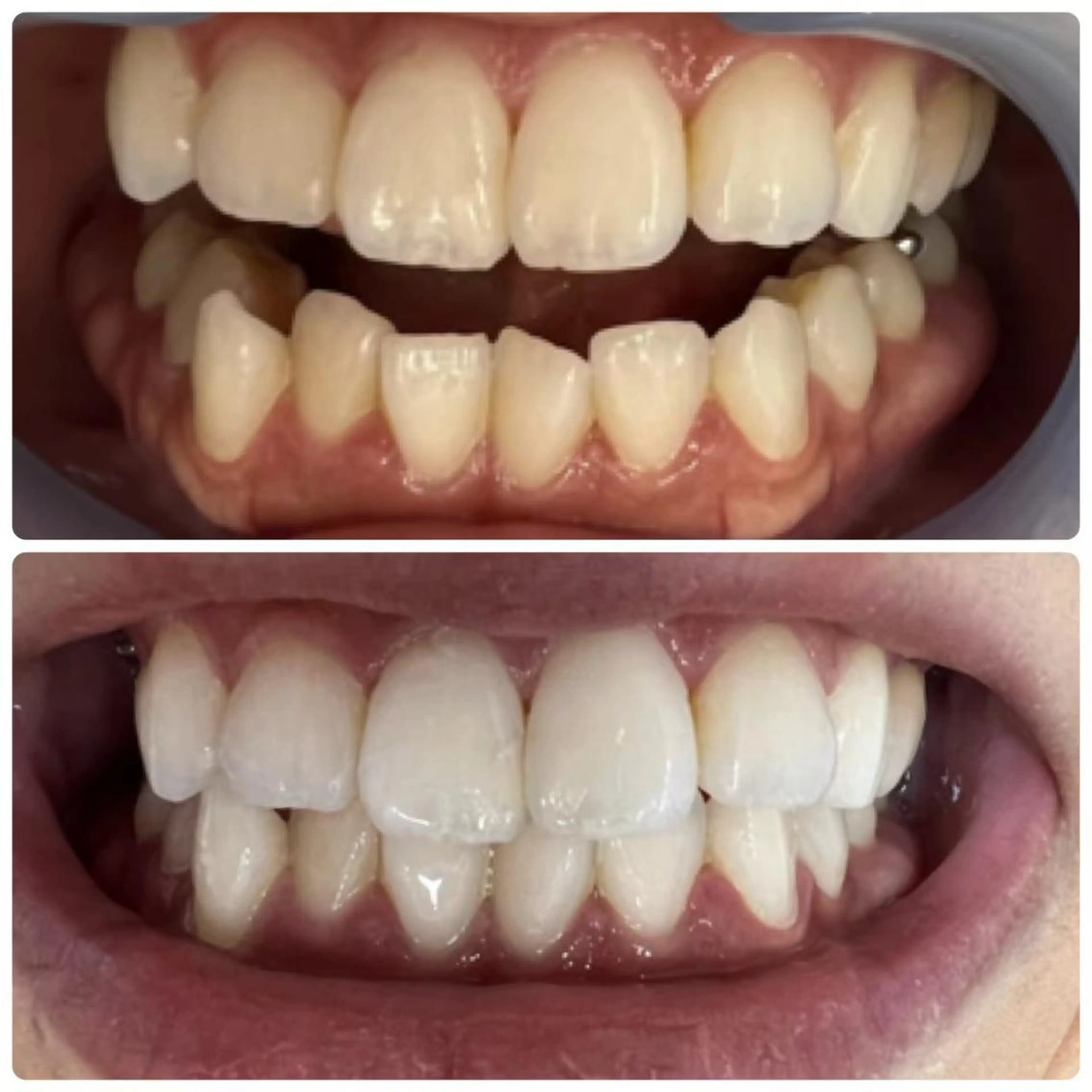 メンズ LOVEホワイト ニング恵比寿店のその他イメージ