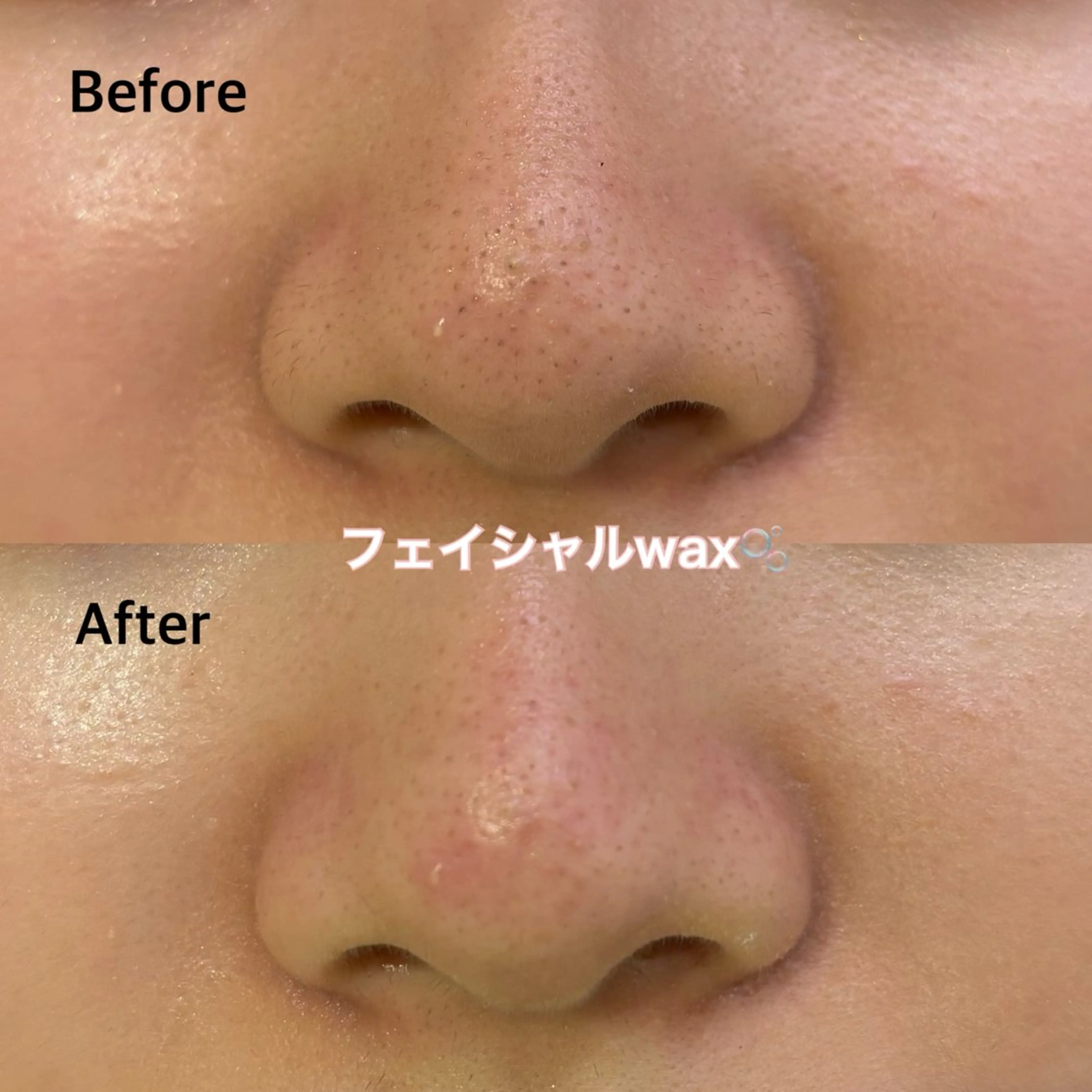 フェイシャルwax(眉込み) ¥8,000→6800の写真