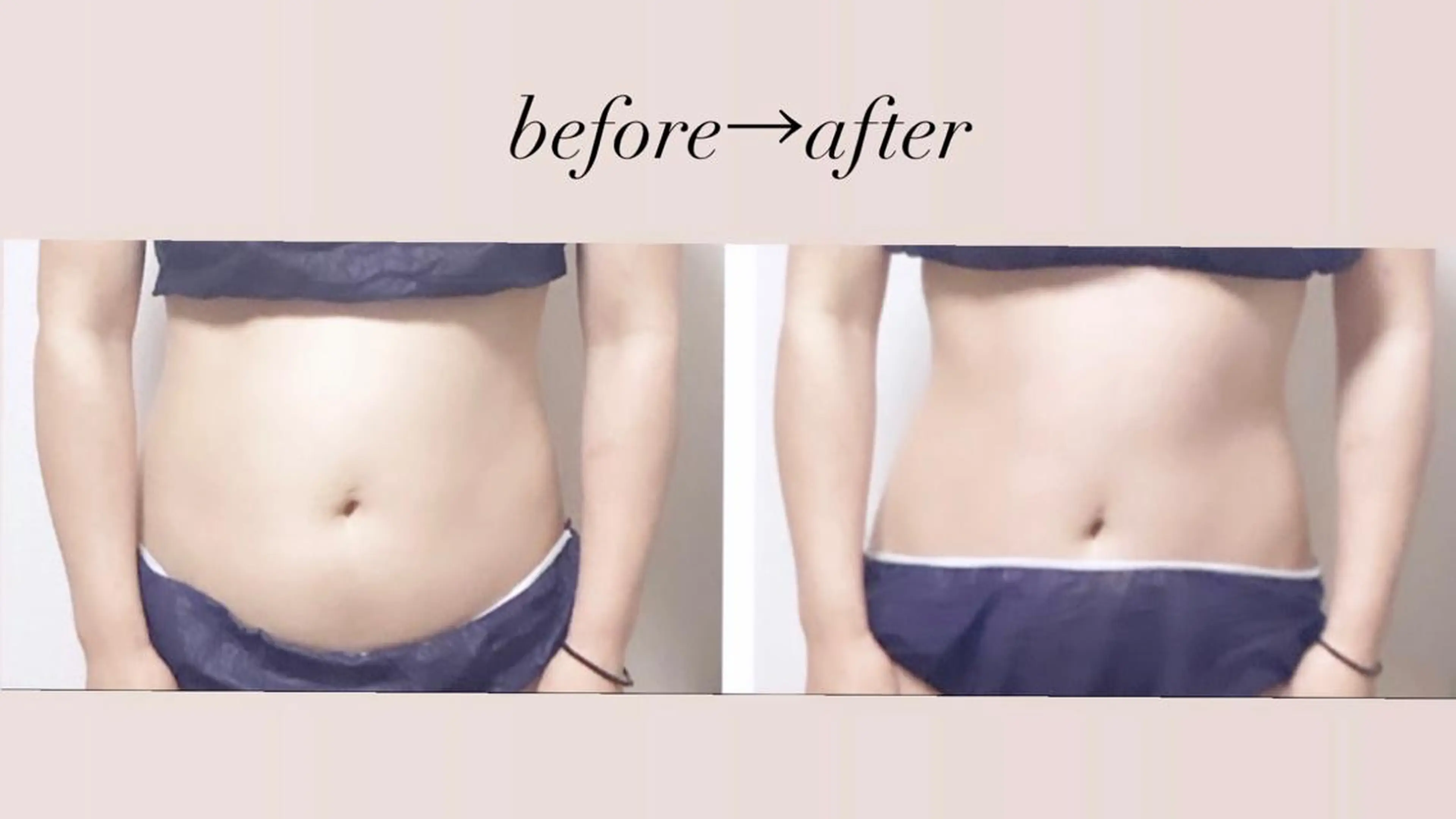 【ウエストくびれ造形コース👙】くびれ/サイズタウン/腰肉/便秘/冷え/の写真