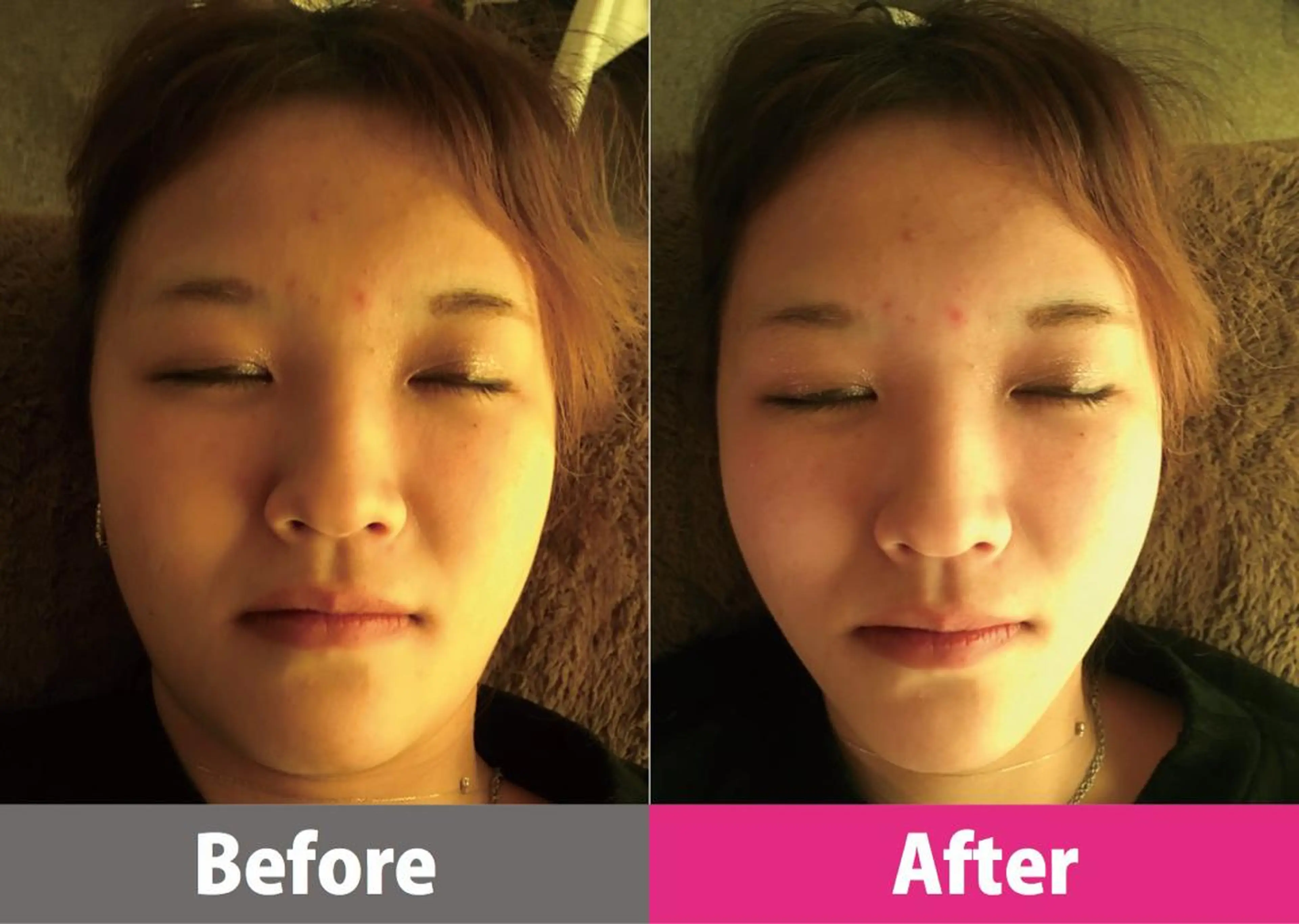 【顔面整体 アルソワート】のエステ・リラクイメージ