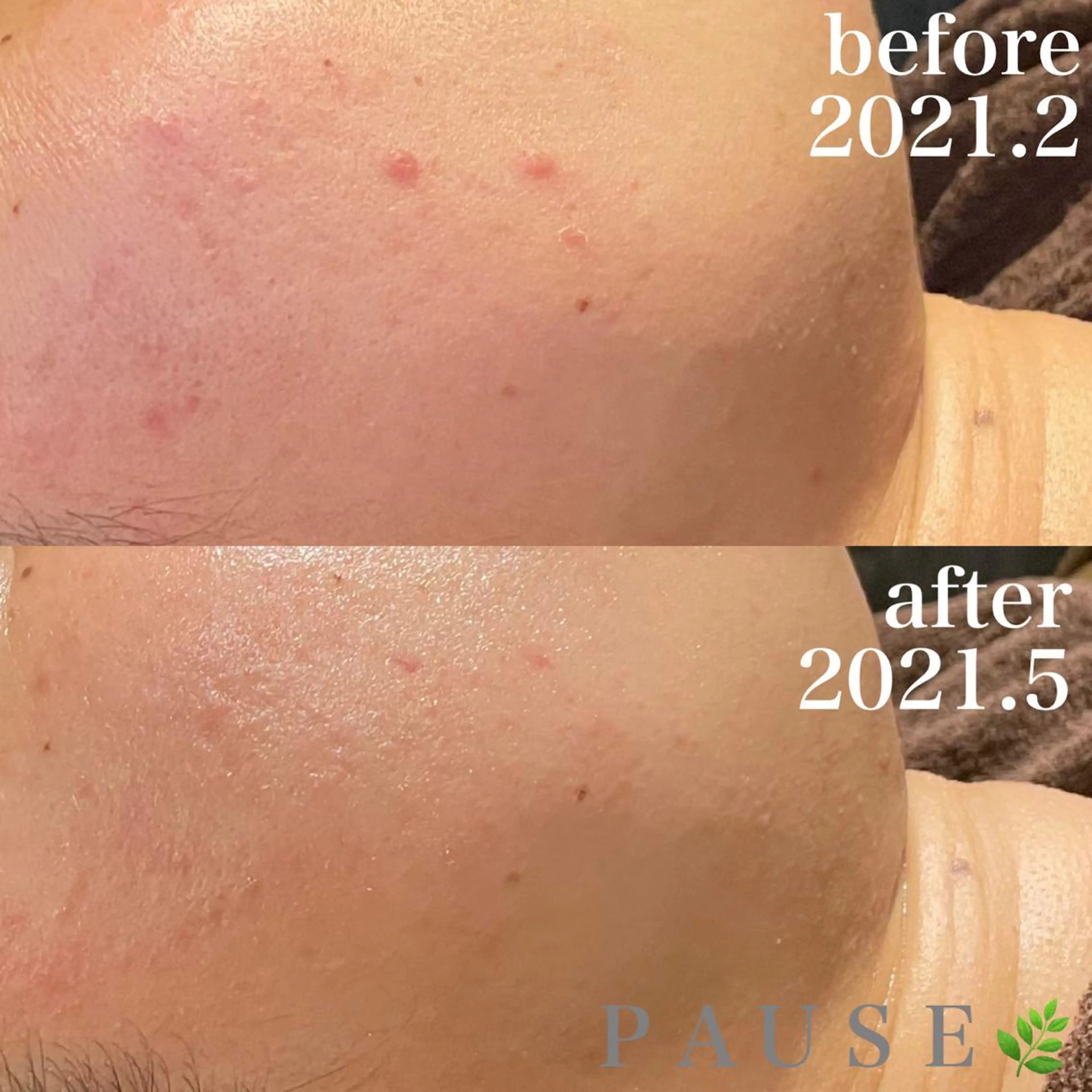 エステ 浜野 恵美のエステ・リラクイメージ