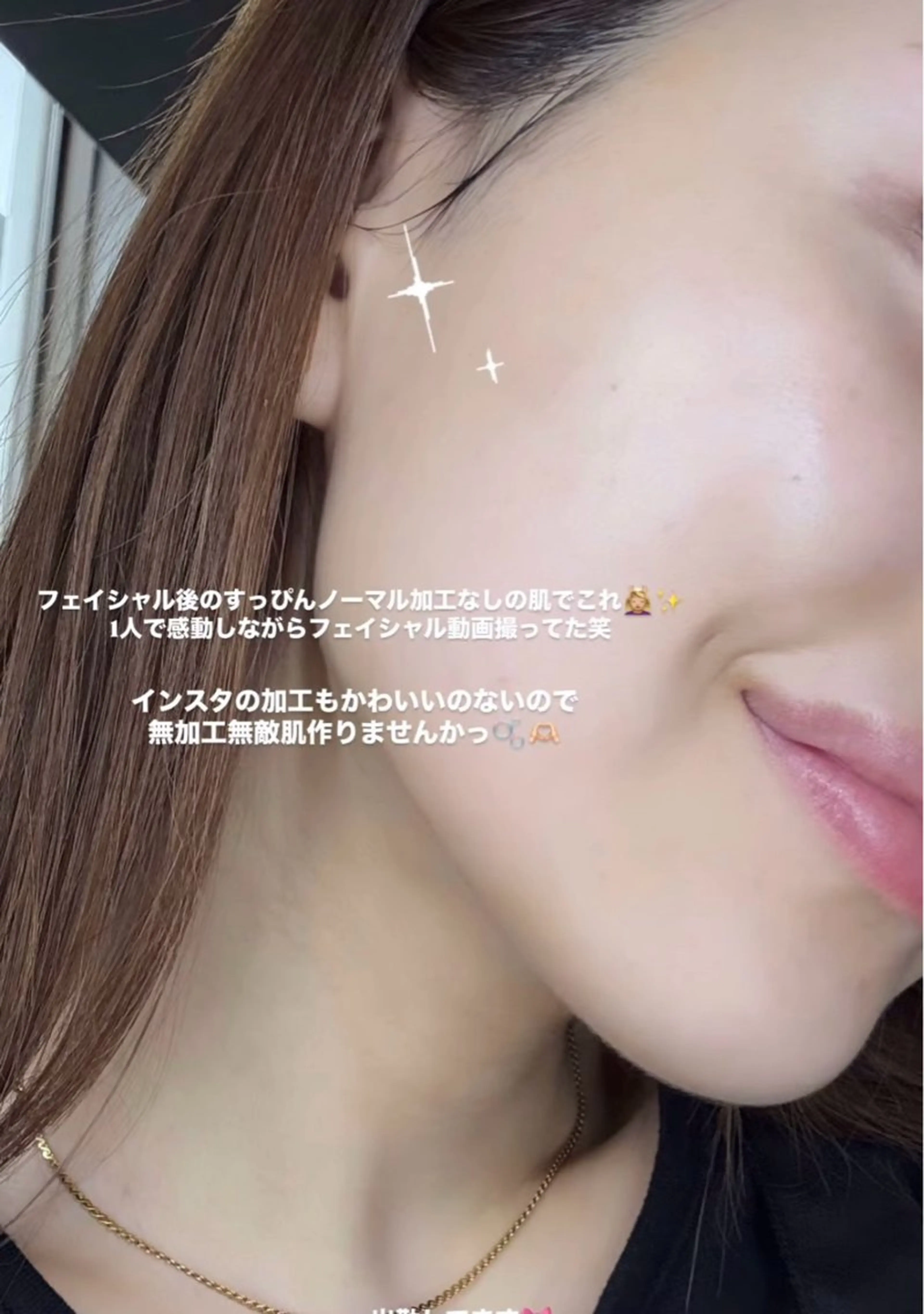 高保湿美肌管理フェイシャル❣️ちぇる肌🍯(もっちりしっとり)の写真