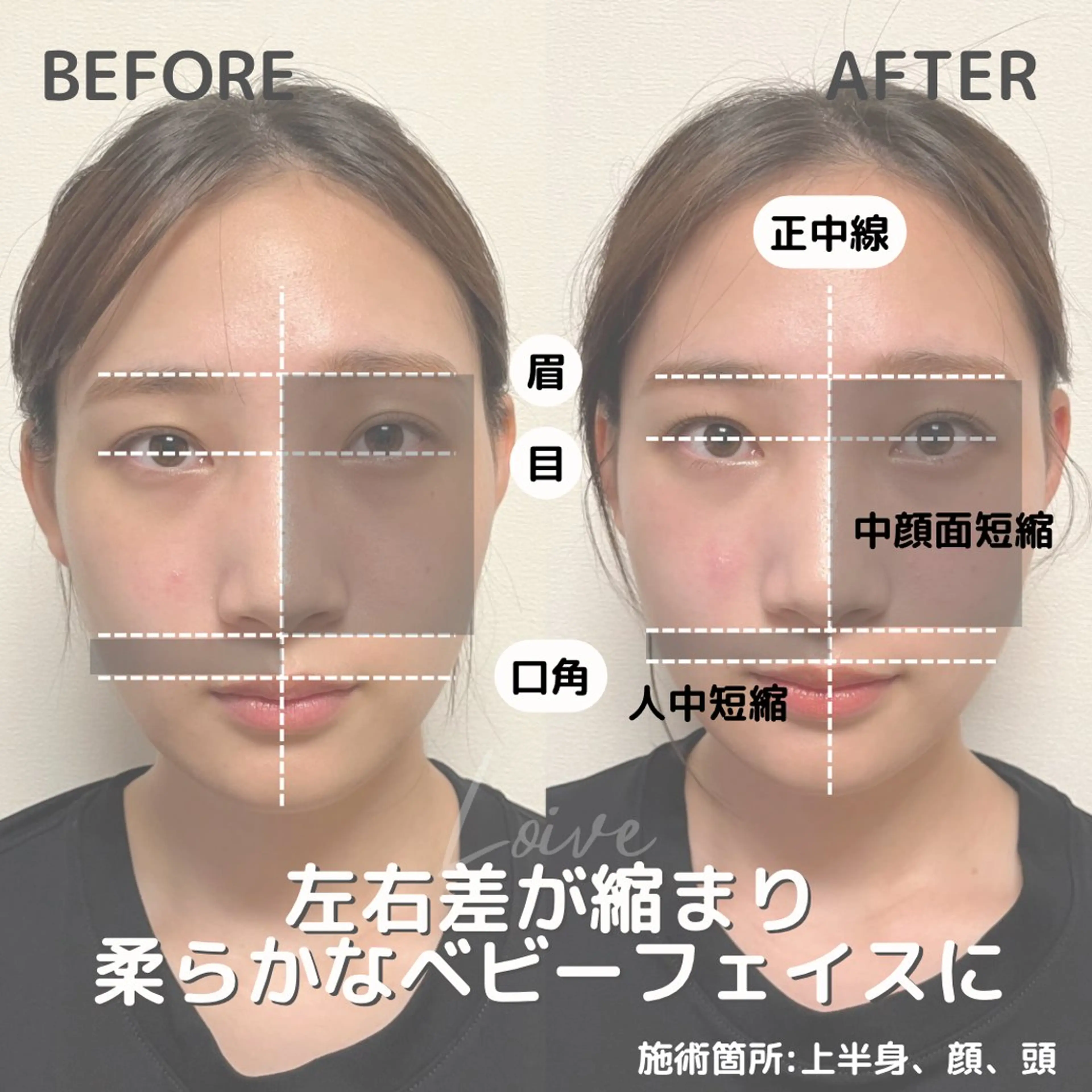 小顔矯正/骨格矯正 AKANEのエステ・リラクイメージ