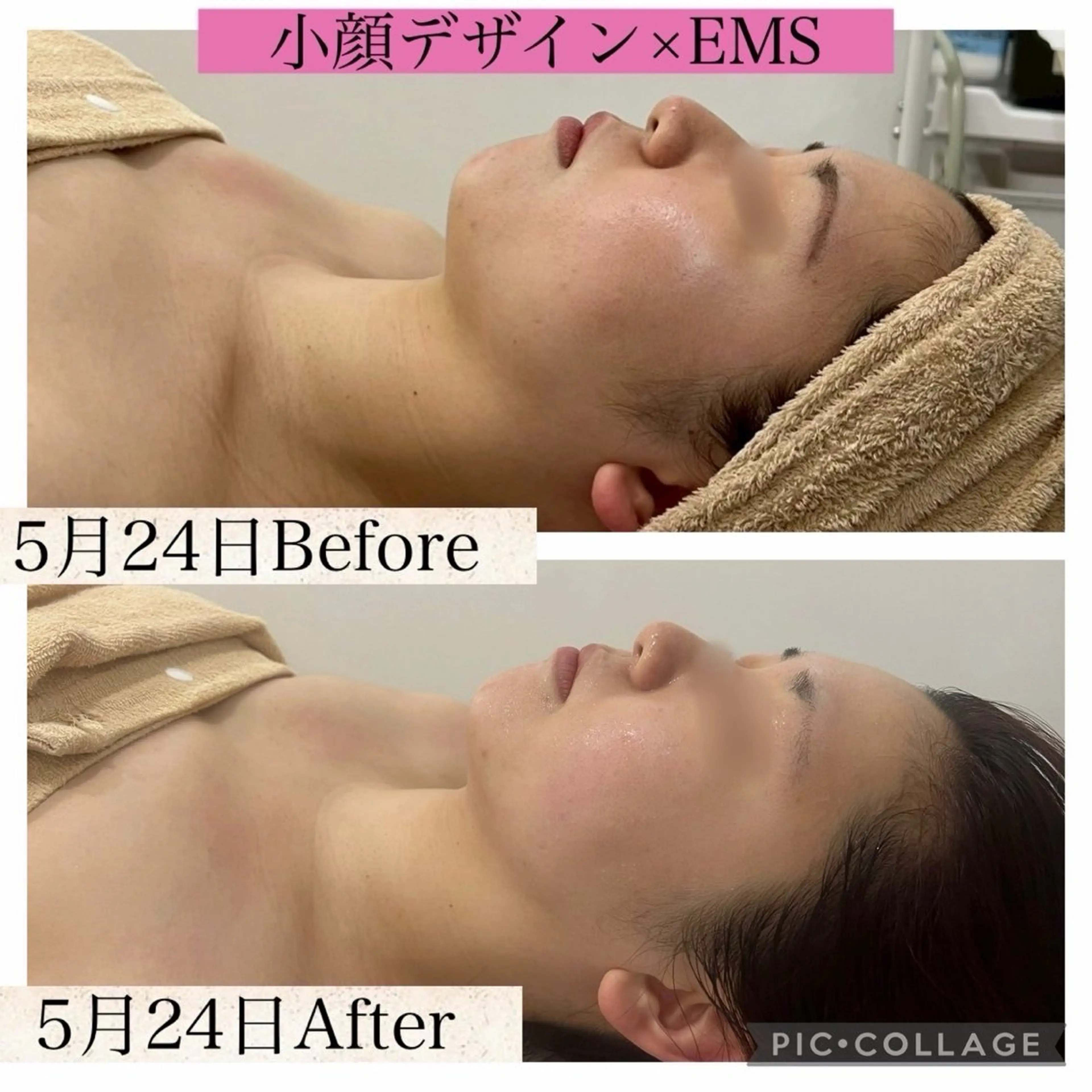 ブライダル痩身×脱毛 尼崎駅前サロンのエステ・リラクイメージ