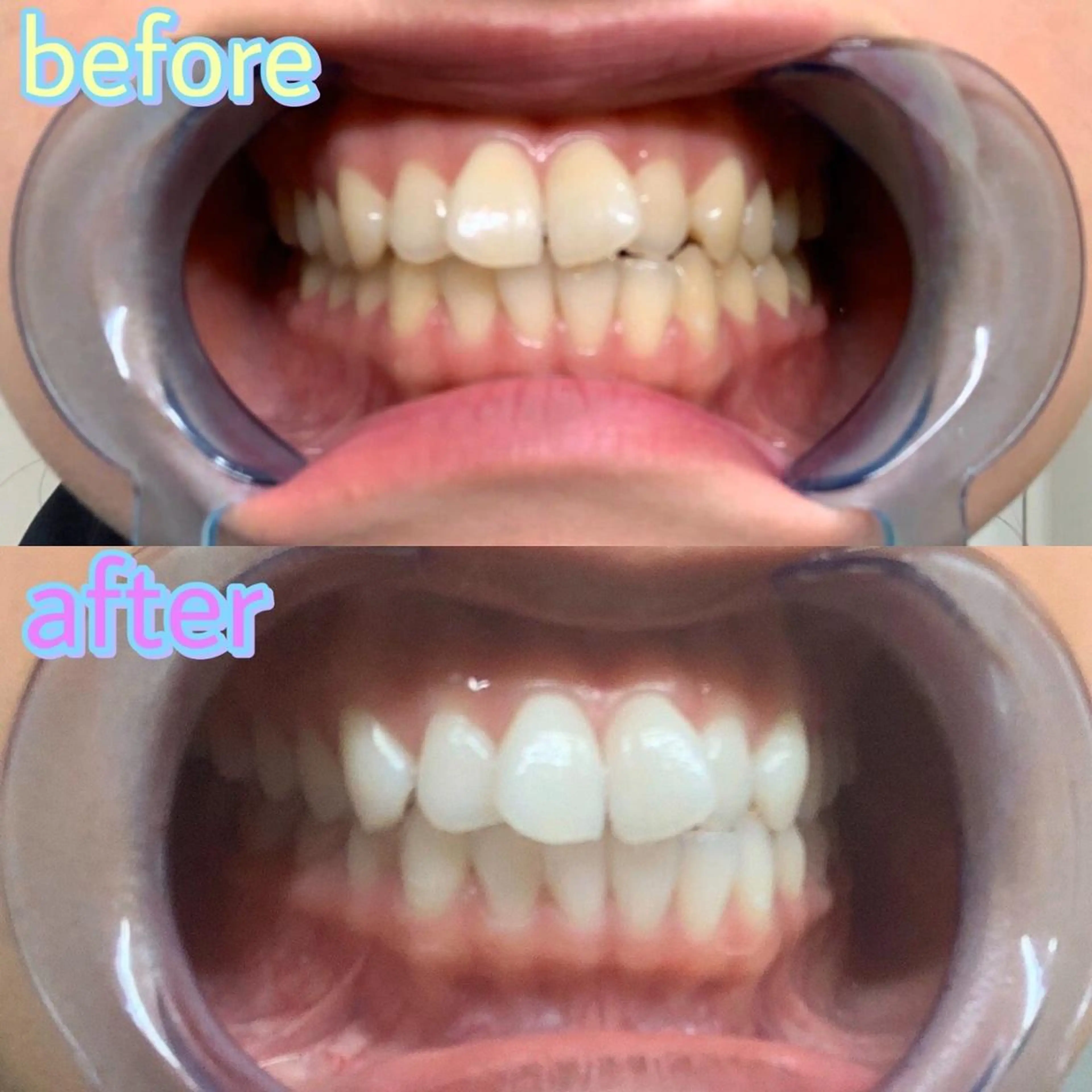 ホワイトニング専門店 LCS 銀座店 峰岡のその他イメージ